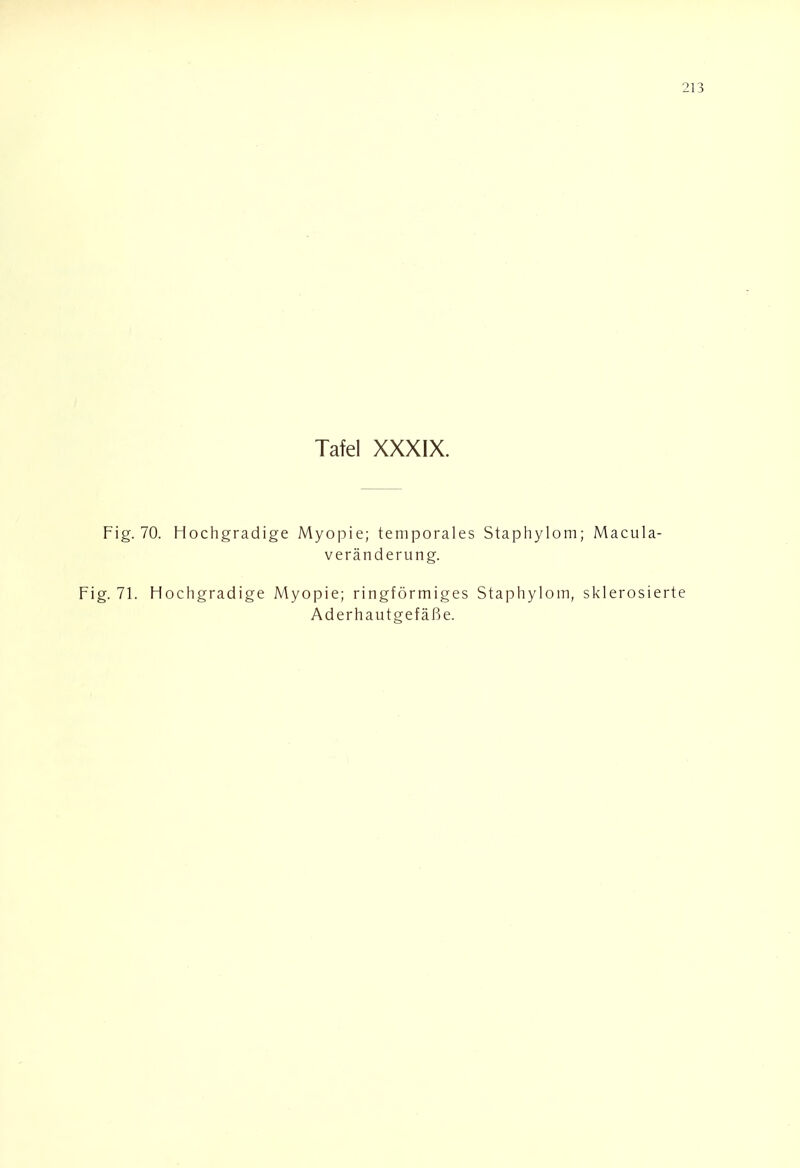 Tafel XXXIX. Fig. 70. Hochgradige Myopie; temporales Staphylom; Macula- veränderung. Fig. 71. Hochgradige Myopie; ringförmiges Staphylom, sklerosierte Aderhautgefäße.