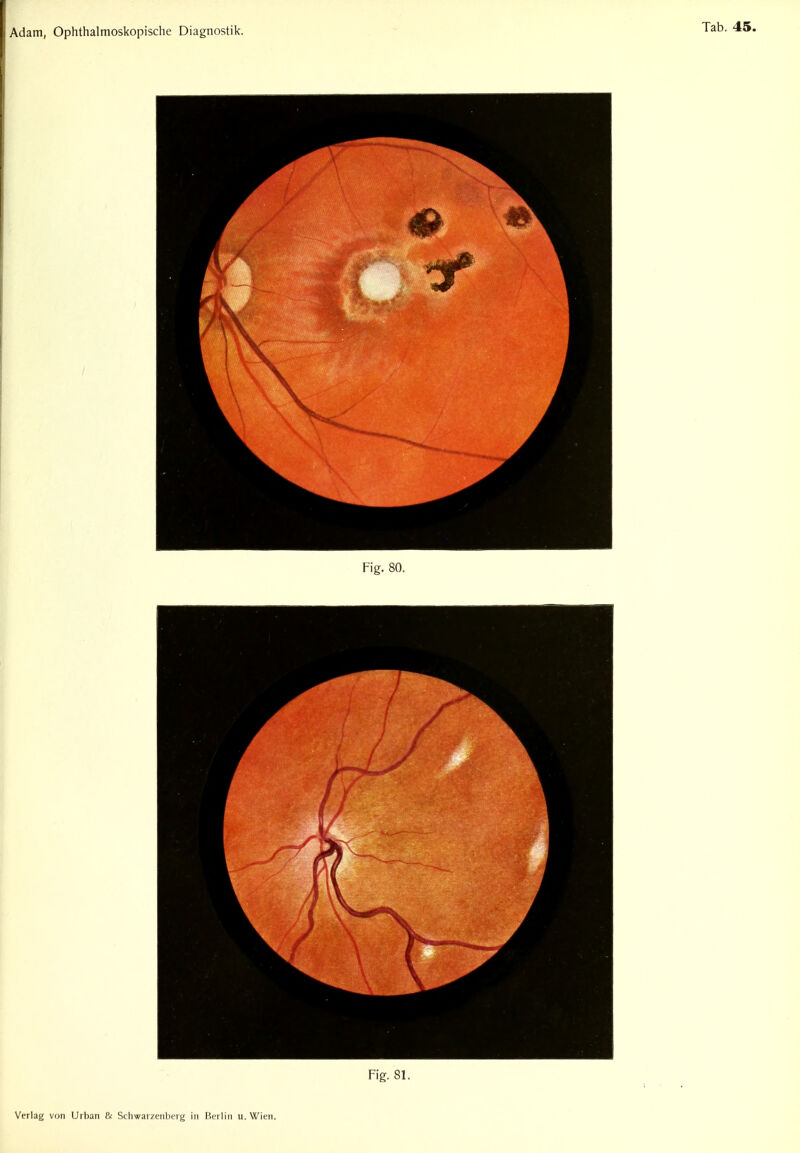 Fig. 81.