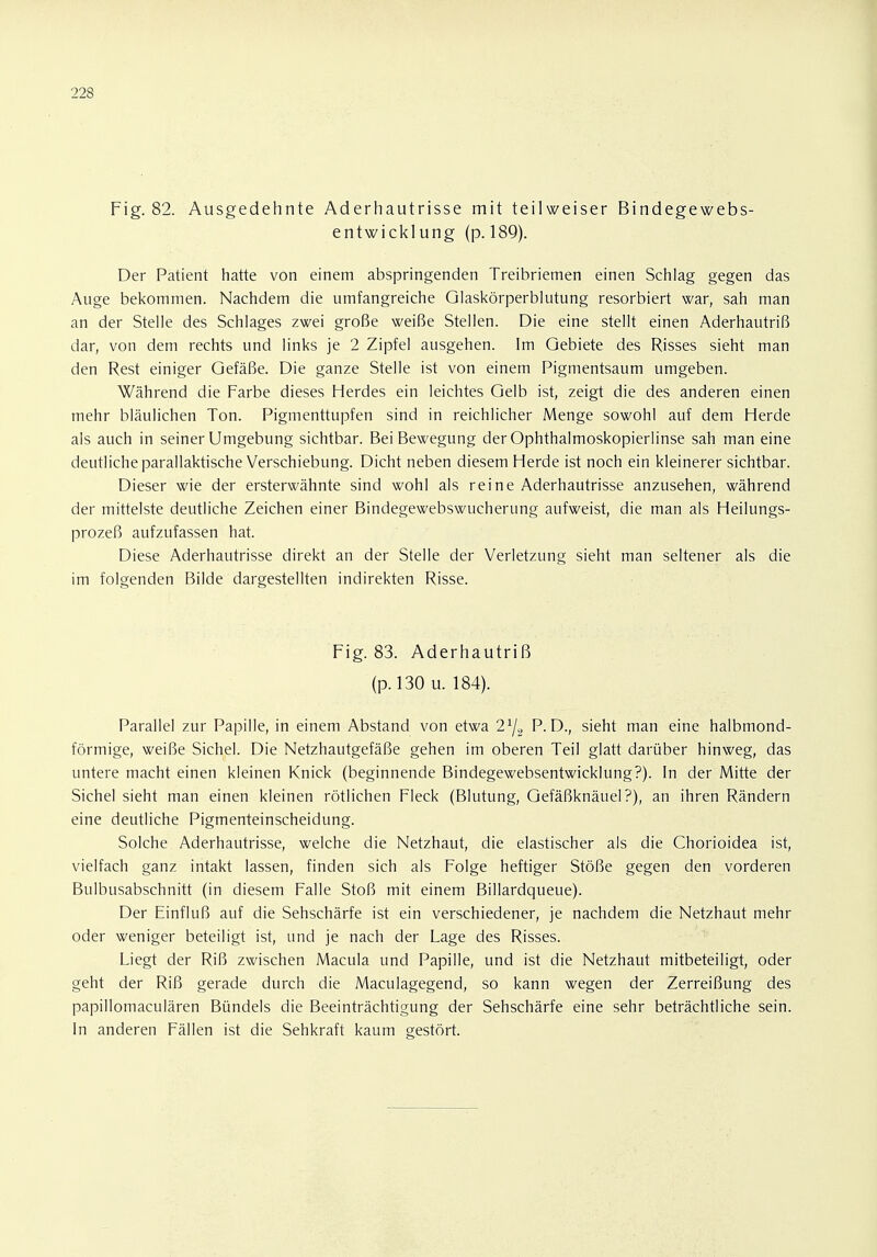 228 Fig. 82. Ausgedehnte Aderhautrisse mit teilweiser Bindegewebs- entwicklung (p. 189). Der Patient hatte von einem abspringenden Treibriemen einen Schlag gegen das Auge bekommen. Nachdem die umfangreiche Glaskörperblutung resorbiert war, sah man an der Stelle des Schlages zwei große weiße Stellen. Die eine stellt einen Aderhautriß dar, von dem rechts und links je 2 Zipfel ausgehen. Im Gebiete des Risses sieht man den Rest einiger Gefäße. Die ganze Stelle ist von einem Pigmentsaum umgeben. Während die Farbe dieses Herdes ein leichtes Gelb ist, zeigt die des anderen einen mehr bläulichen Ton. Pigmenttupfen sind in reichlicher Menge sowohl auf dem Herde als auch in seiner Umgebung sichtbar. Bei Bewegung der Ophthalmoskopierlinse sah man eine deutliche parallaktische Verschiebung. Dicht neben diesem Herde ist noch ein kleinerer sichtbar. Dieser wie der ersterwähnte sind wohl als reine Aderhautrisse anzusehen, während der mittelste deutliche Zeichen einer Bindegewebswucherung aufweist, die man als Heilungs- prozeß aufzufassen hat. Diese Aderhautrisse direkt an der Stelle der Verletzung sieht man seltener als die im folgenden Bilde dargestellten indirekten Risse. Fig. 83. Aderhautriß (p.130 u. 184). Parallel zur Papille, in einem Abstand von etwa 2% P.D., sieht man eine halbmond- förmige, weiße Sichel. Die Netzhautgefäße gehen im oberen Teil glatt darüber hinweg, das untere macht einen kleinen Knick (beginnende Bindegewebsentwicklung?). In der Mitte der Sichel sieht man einen kleinen rötlichen Fleck (Blutung, Gefäßknäuel?), an ihren Rändern eine deutliche Pigmenteinscheidung. Solche Aderhautrisse, welche die Netzhaut, die elastischer als die Chorioidea ist, vielfach ganz intakt lassen, finden sich als Folge heftiger Stöße gegen den vorderen Bulbusabschnitt (in diesem Falle Stoß mit einem Billardqueue). Der Einfluß auf die Sehschärfe ist ein verschiedener, je nachdem die Netzhaut mehr oder weniger beteiligt ist, und je nach der Lage des Risses. Liegt der Riß zwischen Macula und Papille, und ist die Netzhaut mitbeteiligt, oder geht der Riß gerade durch die Maculagegend, so kann wegen der Zerreißung des papillomaculären Bündels die Beeinträchtigung der Sehschärfe eine sehr beträchtliche sein. In anderen Fällen ist die Sehkraft kaum gestört.