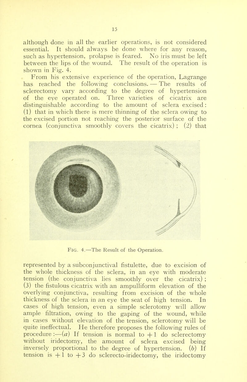 although done in all the earlier operations, is not considered essential. It should always be done where for any reason, such as hypertension, prolapse is feared. No iris must be left between the lips of the wound. The result of the operation is shown in Fig. 4. From his extensive experience of the operation, Lagrange has reached the following conclusions. — The results of sclerectomy vary according to the degree of hypertension of the eye operated on. Three varieties of cicatrix are distinguishable according to the amount of sclera excised: (1) that in which there is mere thinning of the sclera owing to the excised portion not reaching the posterior surface of the cornea (conjunctiva smoothly covers the cicatrix) ; (2) that Fig. 4.—The Result of the Operation. represented by a subconjunctival fistulette, due to excision of the whole thickness of the sclera, in an eye with moderate tension (the conjunctiva lies smoothly over the cicatrix) ; (3) the fistulous cicatrix with an ampulliform elevation of the overlying conjunctiva, resulting from excision of the whole thickness of the sclera in an eye the seat of high tension. In cases of high tension, even a simple sclerotomy will allow ample filtration, owing to the gaping of the wound, while in cases without elevation of the tension, sclerotomy will be quite ineffectual. He therefore proposes the following rules of procedure :—(a) If tension is normal to +1 do sclerectomy without iridectomy, the amount of sclera excised being inversely proportional to the degree of hypertension. (b) If tension is +1 to +3 do sclerecto-iridectomy, the iridectomy