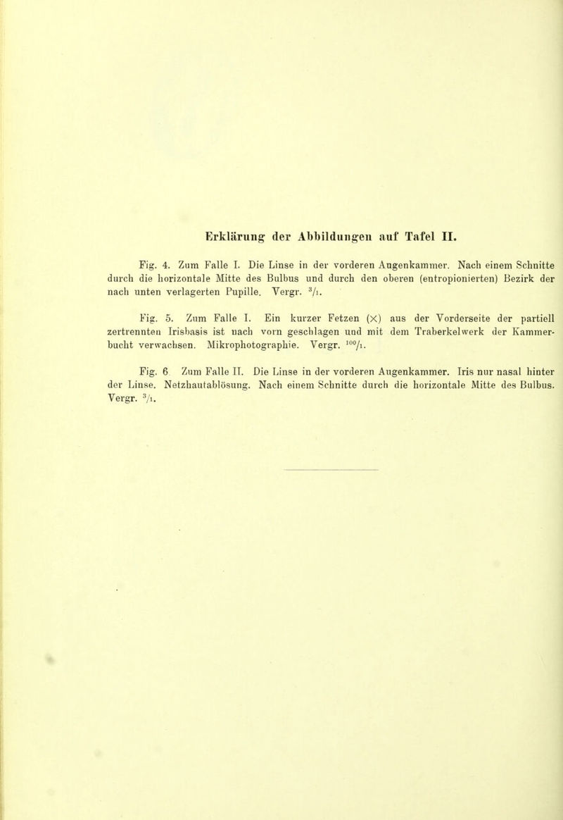 Fig. 4. Zum Falle I. Die Linse in der vorderen Angenkammer. Nach einem Schnitte durch die horizontale Mitte des Bulbus und durch den oberen (entropionierten) Bezirk der nach unten verlagerten Pupille. Vergr. ^/i. Fig. 5. Zum Falle I. Ein kurzer Fetzen (X) aus der Vorderseite der partiell zertrenntet! Irisbasis ist nach vorn geschlagen uod mit dem Traberkelwerk der Kammer- bucht verwachsen. Mikrophotographie, Vergr. Fig. 6 Zum Falle II. Die Linse in der vorderen Augenkammer. Iris nur nasal hinter der Linse. Netzhautablösung. Nach einem Schnitte durch die horizontale Mitte des Bulbus. Vergr. ^/i.