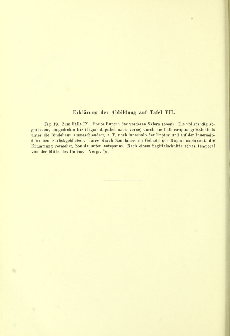 Fig. 19. Zum Falle IX. Breite Ruptur der vorderen Sklera (oben). Die vollständig ab- gerissene, umgedrehte Iris (Pigmentepithel nach vorne) durch die Bulbusruptur grösstenteils unter die Bindehaut ausgeschleudert, z. T. noch innerhalb der Ruptur und auf der Innenseite derselben zurückgeblieben. Linse durch Zonulariss im Gebiete der Ruptur subluxiert, die Krümmung vermehrt, Zonula unten entspannt. Nach einem Sagittaisclmitte etwas temporal von der Mitte des Bulbus. Vergr. ^Ji.