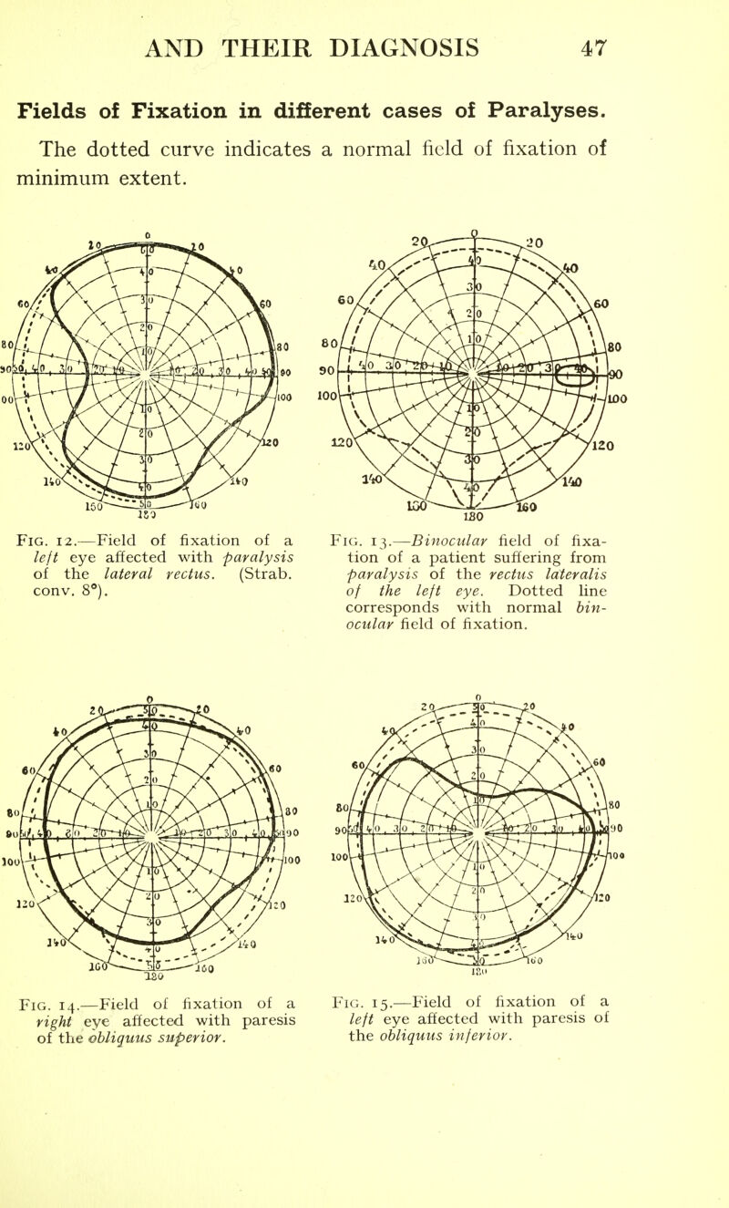 Fields of Fixation in different cases of Paralyses. The dotted curve indicates a normal field of fixation of minimum extent. 80 80 It 90 90 1 1 100 100 ML. Fig. 12.—Field of fixation of a left eye affected with paralysis of the lateral rectus. (Strab. conv. 8*'). 120 180 169 Fig. 13.—Binocular field of fixa- tion of a patient suffering from paralysis of the rectus lateralis of the left eye. Dotted line corresponds with normal bin- ocular field of fixation. Fig. 14.—Field of fixation of a Fig. 15.—Field of fixation of a right eye affected with paresis left eye affected with paresis of of the ebliquus superior. the ohliquus inferior.