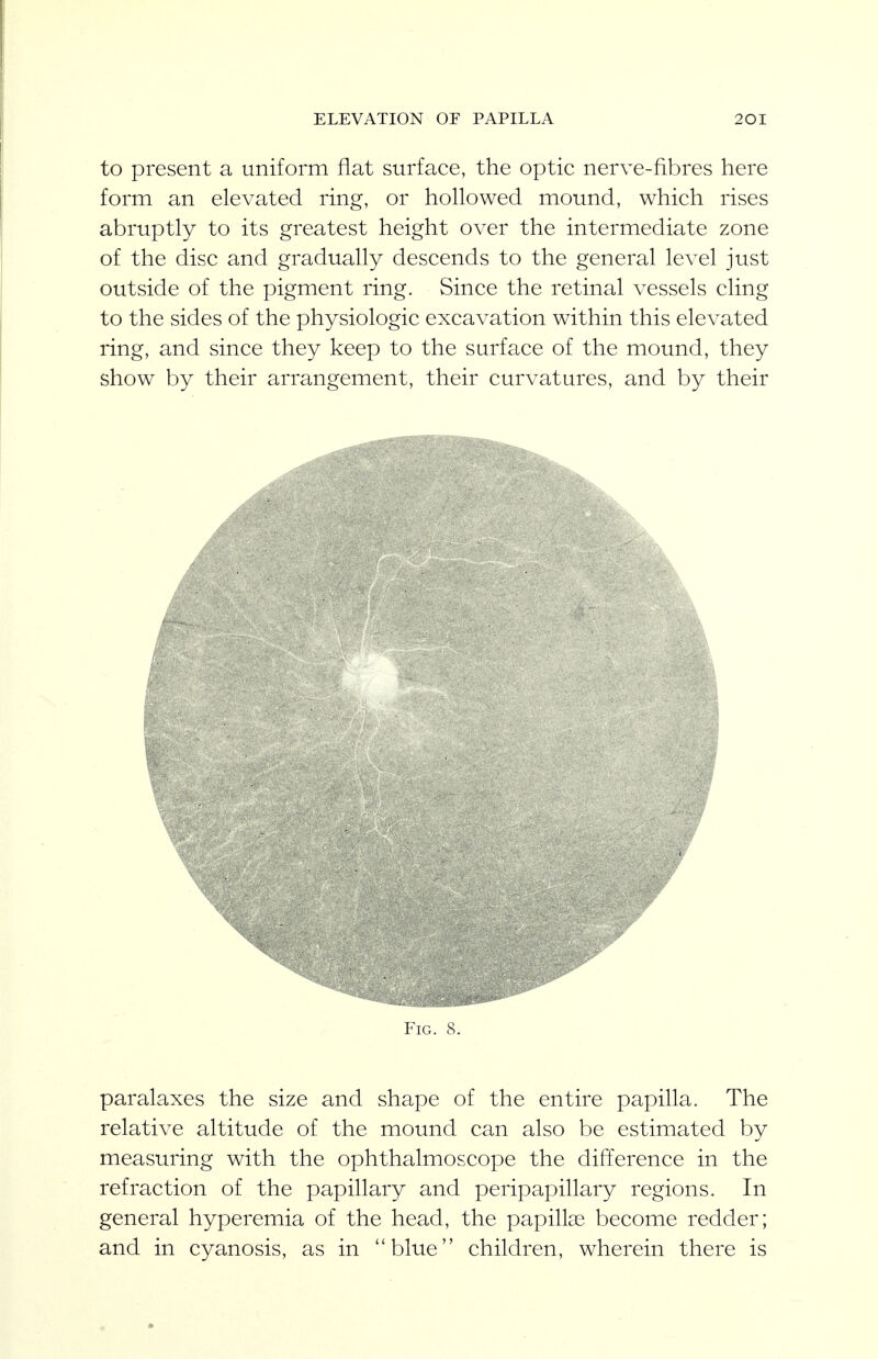 to present a uniform flat surface, the optic nerve-fibres here form an elevated ring, or hollowed mound, which rises abruptly to its greatest height over the intermediate zone of the disc and gradually descends to the general level just outside of the pigment ring. Since the retinal vessels cling to the sides of the physiologic excavation within this elevated ring, and since they keep to the surface of the mound, they show by their arrangement, their curvatures, and by their Fig. 8. paralaxes the size and shape of the entire papilla. The relative altitude of the mound can also be estimated by measuring with the ophthalmoscope the difference in the refraction of the papillary and peripapillary regions. In general hyperemia of the head, the papillae become redder; and in cyanosis, as in blue children, wherein there is