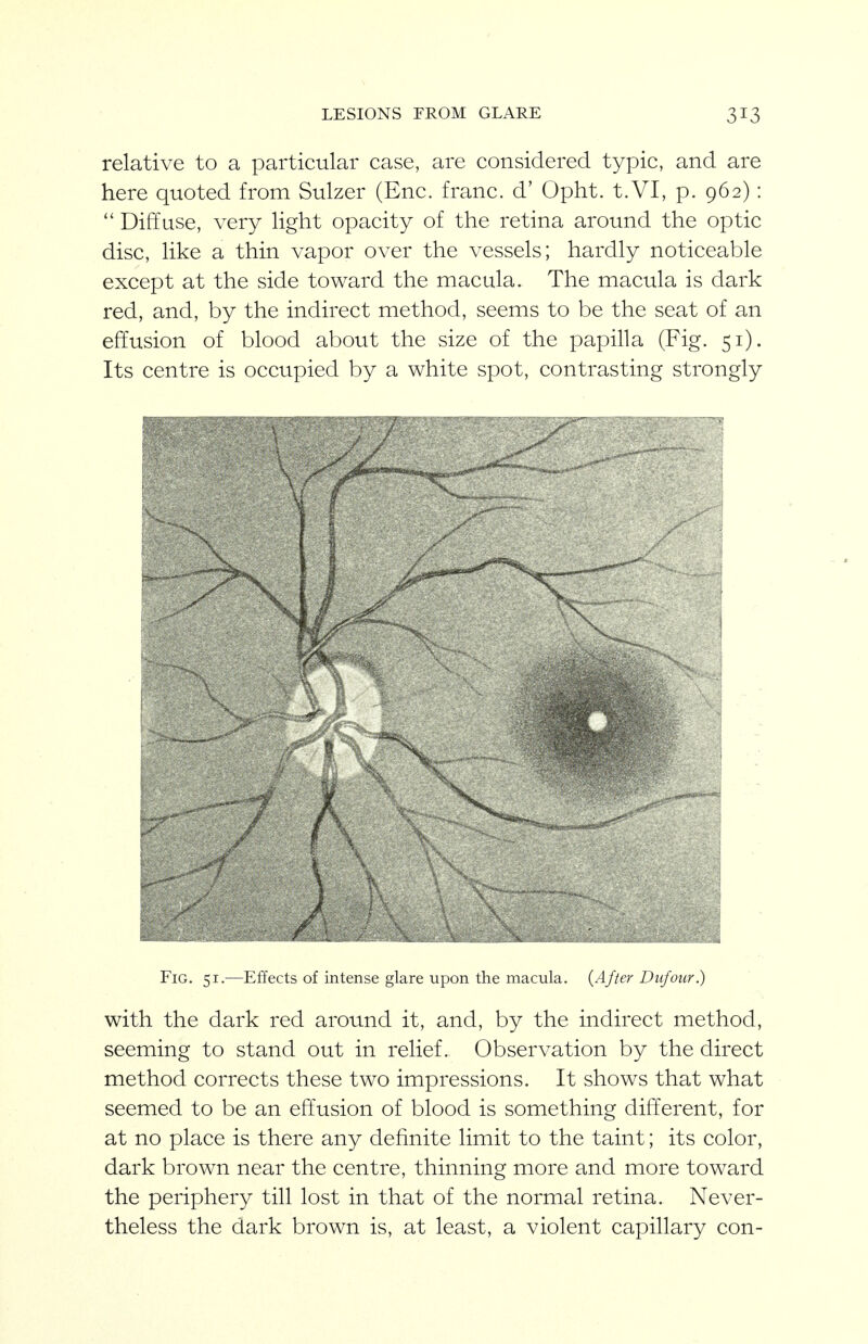 LESIONS FROM GLARE relative to a particular case, ai e considered typic, and are here quoted from Sulzer (Enc. franc, d' Opht. t.VI, p. 962): Diffuse, very light opacity of the retina around the optic disc, like a thin vapor over the vessels; hardly noticeable except at the side toward the macula. The macula is dark red, and, by the indirect method, seems to be the seat of an effusion of blood about the size of the papilla (Fig. 51). Its centre is occupied by a white spot, contrasting strongly Fig. 51.—Effects of intense glare upon the macula. {After Dufoiir.) with the dark red around it, and, by the indirect method, seeming to stand out in relief. Observation by the direct method corrects these two impressions. It shows that what seemed to be an effusion of blood is something different, for at no place is there any definite limit to the taint; its color, dark brown near the centre, thinning more and more toward the periphery till lost in that of the normal retina. Never- theless the dark brown is, at least, a violent capillary con-