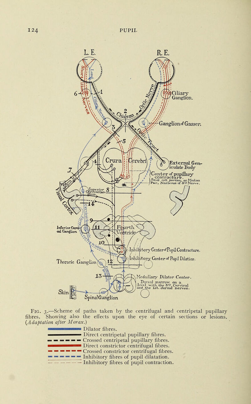 L. E. Ciliary Gang-lion. '^^-'GanglioiLof Gasser. erebrijf (^WternaLGen- 1 /Center of pupillary t contracture. * ) Small cell portion, or Median -/Pair, Kucleous of 35?Nerve. tor}' Ceitterof Pupil Contracture. itop^Center of Pupil Dilation. Medullary Dilator Center. Dorsal marrow on a level with, the 8 - Cervical ar.dthe 1st. dorsal nerves. Fig. 3.—Scheme of paths taken by the centrifugal and centripetal pupillary fibres. Showing also the effects upon the eye of certain sections or lesions. (Adaptation after Morax.) i^mmmetmmmze Dilator fibres. —— Direct centripetal pupillary fibres. — — Crossed centripetal pupillary fibres. Direct constrictor centrifugal fibres. — —— — — — Crossed constrictor centrifugal fibres. — — — — — — Inhibitory fibres of pupil dilatation. Inhibitory fibres of pupil contraction.