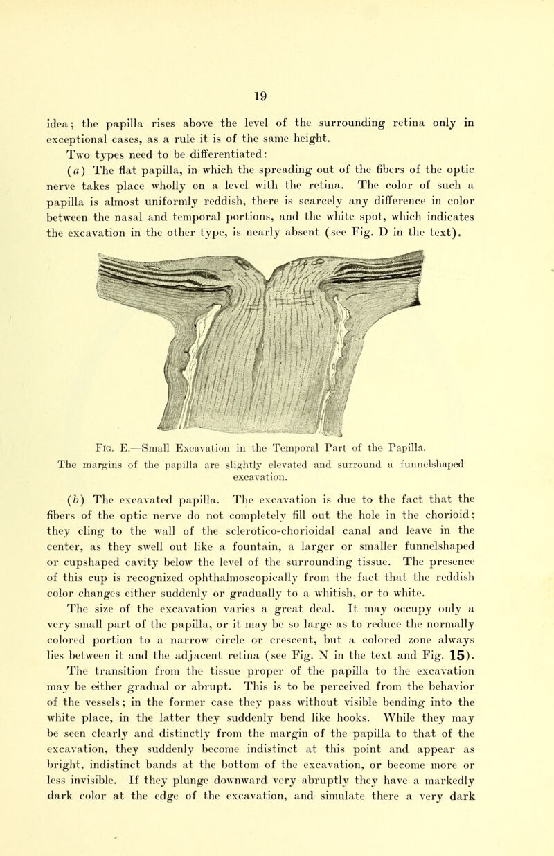 idea; the papilla rises above the level of the surrounding retina only in exceptional cases, as a rule it is of the same height. Two types need to be differentiated: (a) The flat papilla, in which the spreading out of the fibers of the optic nerve takes place wholly on a level with the retina. The color of such a papilla is almost uniformly reddish, there is scarcely any difference in color between the nasal and temporal portions, and the white spot, which indicates the excavation in the other type, is nearly absent (see Fig. D in the text). Fig. E.—Small Excavation in the Temporal Part of the Papilla. The margins of the papilla are slightly elevated and surround a fumielshaped excavation. (b) The excavated papilla. The excavation is due to the fact that the fibers of the optic nerve do not completely fill out the hole in the chorioid; they cling to the wall of the sclerotico-chorioidal canal and leave in the center, as they swell out like a fountain, a larger or smaller funnelshaped or cupshaped cavity below the level of the surrounding tissue. The presence of this cup is recognized ophthalmoscopically from the fact that the reddish color changes either suddenly or gradually to a whitish, or to white. The size of the excavation varies a great deal. It may occupy only a very small part of the papilla, or it may be so large as to reduce the normally colored portion to a narrow circle or crescent, but a colored zone always lies between it and the adjacent retina (see Fig. N in the text and Fig. 15)- The transition from the tissue proper of the papilla to the excavation may be either gradual or abrupt. This is to be perceived from the behavior of the vessels; in the former case they pass without visible bending into the white place, in the latter they suddenly bend like hooks. While they may be seen clearly and distinctly from the mai'gin of the papilla to that of the excavation, they suddenly become indistinct at this point and appeal' as bright, indistinct bands at the bottom of the excavation, or become more or less invisible. If they plunge downward very abruptly they have a markedly dark color at the edge of the excavation, and simulate there a very dark