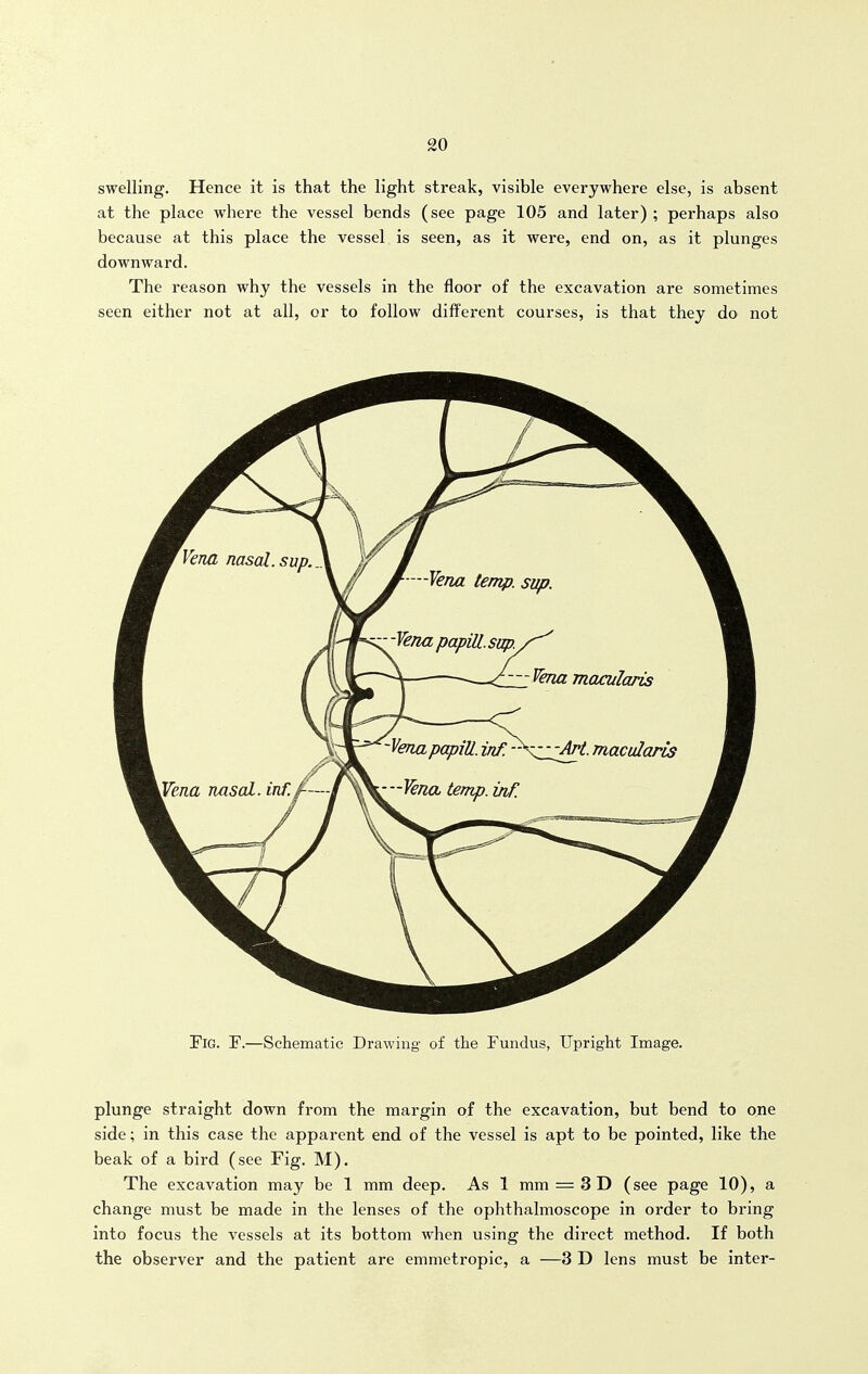 swelling. Hence it is that the light streak, visible everywhere else, is absent at the place where the vessel bends (see page 105 and later) ; perhaps also because at this place the vessel is seen, as it were, end on, as it plunges downward. The reason why the vessels in the floor of the excavation are sometimes seen either not at all, or to follow different courses, is that they do not Fig. F.—Schematic Drawing of the Fundus, Upright Image. plunge straight down from the margin of the excavation, but bend to one side; in this case the apparent end of the vessel is apt to be pointed, like the beak of a bird (see Fig. M). The excavation may be 1 mm deep. As 1 mm = 3 D (see page 10), a change must be made in the lenses of the ophthalmoscope in order to bring into focus the vessels at its bottom when using the direct method. If both the observer and the patient are emmetropic, a —3 D lens must be inter-