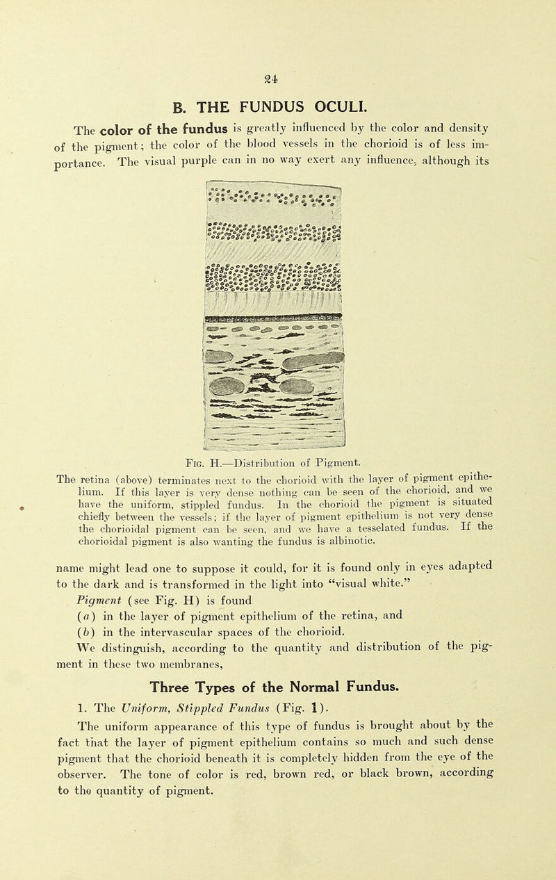 B. THE FUNDUS OCULI. The color of the fundus is greatly influenced by the color and density of the pigment; the color of the blood vessels in the chorioid is of less im- portance. The visual purple can in no way exert any influence^ although its Fig. H.—Distribution of Pigment. The retina (above) terminates next to the chorioid with the layer of pigment epithe- lium. If this layer is very dense nothing can be seen of the chorioid, and we have the uniform, stippled fundus. In the chorioid the pigment is situated chiefly between the vessels; if the layer of pigment epithelium is not very dense the chorioidal pigment can be seen, and we have a tesselated fundus. If the chorioidal pigment is also wanting the fundus is albinotic. name might lead one to suppose it could, for it is found only in eyes adapted to the dark and is transformed in the light into visual white. Pigment (see Fig. H) is found (a) in the layer of pigment epithelium of the retina, and (6) in the intervascular spaces of the chorioid. We distinguish, according to the quantity and distribution of the pig- ment in these two membranes, Three Types of the Normal Fundus. 1. The Uniform, Stippled Fundus (Fig. 1), The uniform appearance of this type of fundus is brought about by the fact that the layer of pigment epithelium contains so much and such dense pigment that the chorioid beneath it is completely hidden from the eye of the observer. The tone of color is red, brown red, or black brown, according to the quantity of pigment.