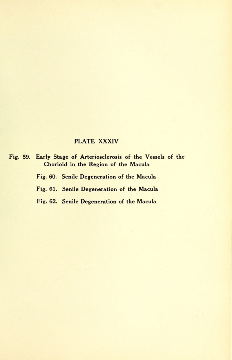Fig. 59. Early Stage of Arteriosclerosis of the Vessels of the Chorioid in the Region of the Macula Fig. 60. Senile Degeneration of the Macula Fig. 61. Senile Degeneration of the Macula Fig. 62. Senile Degeneration of the Macula