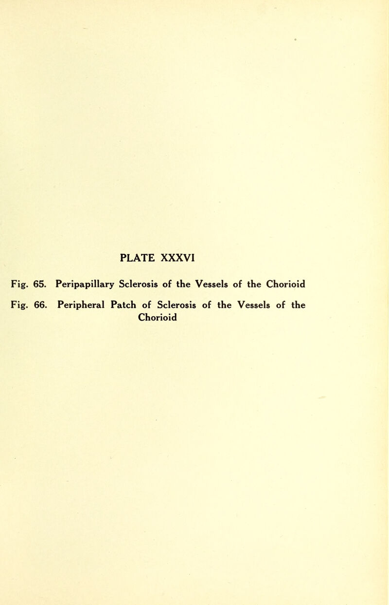 Fig. 65. Peripapillary Sclerosis of the Vessels of the Chorioid Fig. 66. Peripheral Patch of Sclerosis of the Vessels of the Chorioid