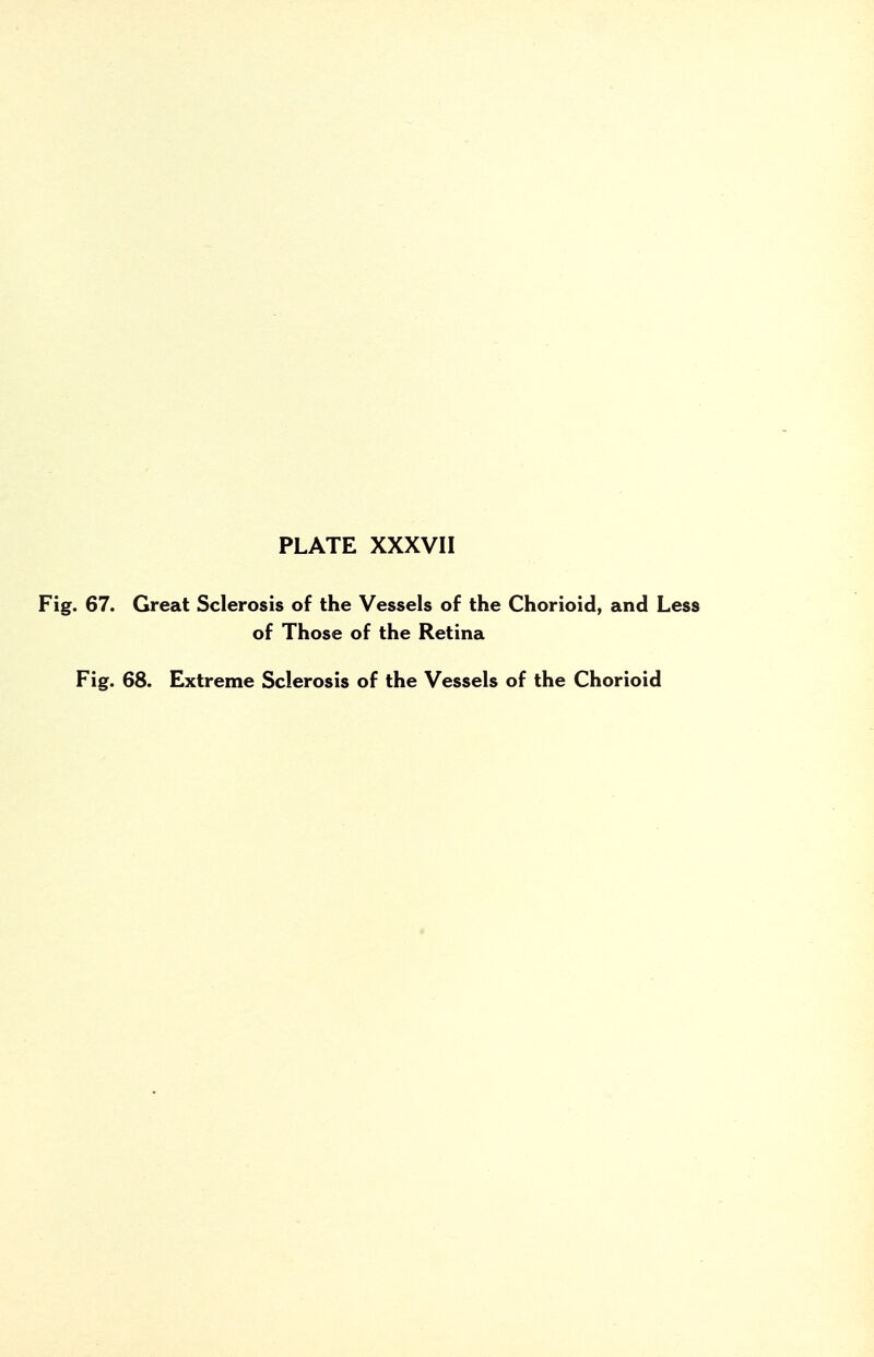 Fig. 67. Great Sclerosis of the Vessels of the Chorioid, and Less of Those of the Retina Fig. 68. Extreme Sclerosis of the Vessels of the Chorioid 4