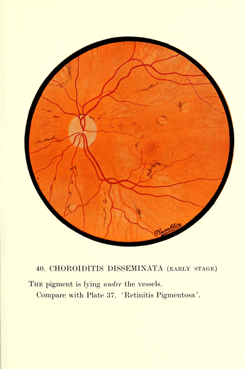 The pigment is lying under the vessels.