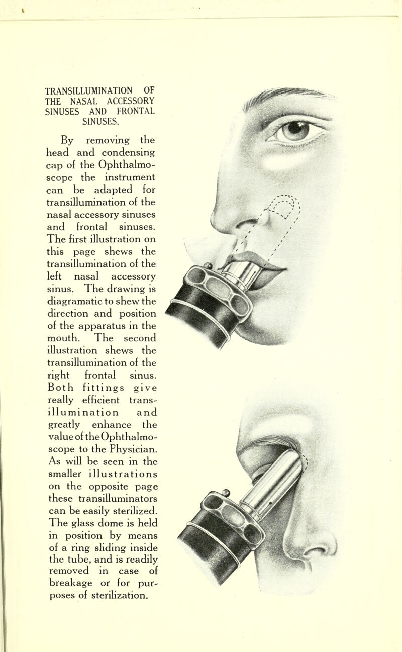 TRANSILLUMINATION OF THE NASAL ACCESSORY SINUSES AND FRONTAL SINUSES. By removing the head and condensing cap of the Ophthalmo- scope the instrument can be adapted for transillumination of the nasal accessory sinuses and frontal sinuses. The first illustration on this page shews the transillumination of the left nasal accessory sinus. The drawing is diagramatic to shew the direction and position of the apparatus in the mouth. The second illustration shews the transillumination of the right frontal sinus. Both fittings give really efficient trans- illumination and greatly enhance the value of the Ophthalmo- scope to the Physician. As will be seen in the smaller illustrations on the opposite page these transilluminators can be easily sterilized. The glass dome is held in position by means of a ring sliding inside the tube, and is readily removed in case of breakage or for pur- poses of sterilization.