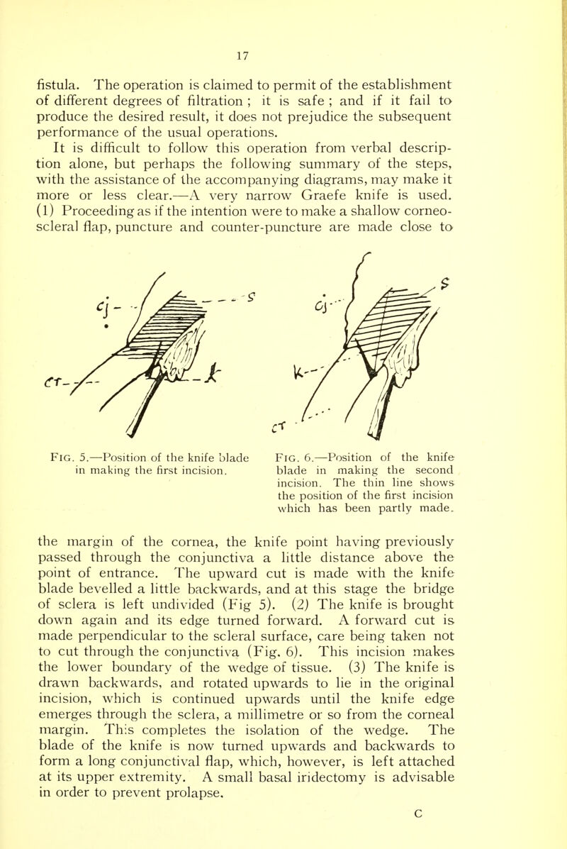 fistula. The operation is claimed to permit of the establishment of different degrees of filtration ; it is safe ; and if it fail to produce the desired result, it does not prejudice the subsequent performance of the usual operations. It is difficult to follow this operation from verbal descrip- tion alone, but perhaps the following summary of the steps, with the assistance of the accompanying diagrams, may make it more or less clear.—A very narrow Graefe knife is used, (l) Proceeding as if the intention were to make a shallow corneo- scleral flap, puncture and counter-puncture are made close to Fig. 5.—Position of the knife blade Fig. 6.—Position of the knife the margin of the cornea, the knife point having previously passed through the conjunctiva a little distance above the point of entrance. The upward cut is made with the knife blade bevelled a little backwards, and at this stage the bridge of sclera is left undivided (Fig 5). (2) The knife is brought down again and its edge turned forward. A forward cut is made perpendicular to the scleral surface, care being taken not to cut through the conjunctiva (Fig. 6). This incision makes the lower boundary of the wedge of tissue. (3) The knife is drawn backwards, and rotated upwards to lie in the original incision, which is continued upwards until the knife edge emerges through the sclera, a millimetre or so from the corneal margin. This completes the isolation of the wedge. The blade of the knife is now turned upwards and backwards to form a long conjunctival flap, which, however, is left attached at its upper extremity. A small basal iridectomy is advisable in order to prevent prolapse. in making the first incision. blade in making the second incision. The thin Hne shows the position of the first incision which has been partly made. C