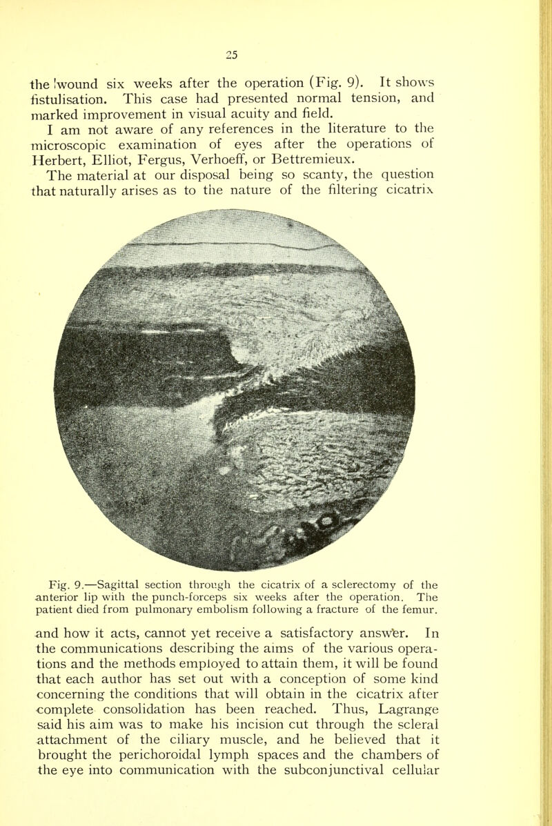 the'wound six weeks after the operation (Fig. 9). It shows fistulisation. This case had presented normal tension, and marked improvement in visual acuity and field. I am not aware of any references in the literature to the microscopic examination of eyes after the operations of Herbert, EUiot, Fergus, Verhoeff, or Bettremieux. The material at our disposal being so scanty, the question that naturally arises as to the nature of the filtering cicatrix Fig. 9.—Sagittal section through the cicatrix of a sclerectomy of the anterior lip with the punch-forceps six weeks after the operation. The patient died from pulmonary embolism following a fracture of the femur. and how it acts, cannot yet receive a satisfactory answ'er. In the communications describing the aims of the various opera- tions and the methods employed to attain them, it will be found that each author has set out with a conception of some kind concerning the conditions that will obtain in the cicatrix after ■complete consolidation has been reached. Thus, Lagrange said his aim was to make his incision cut through the scleral attachment of the ciliary muscle, and he believed that it brought the perichoroidal lymph spaces and the chambers of the eye into communication with the subconjunctival cellular