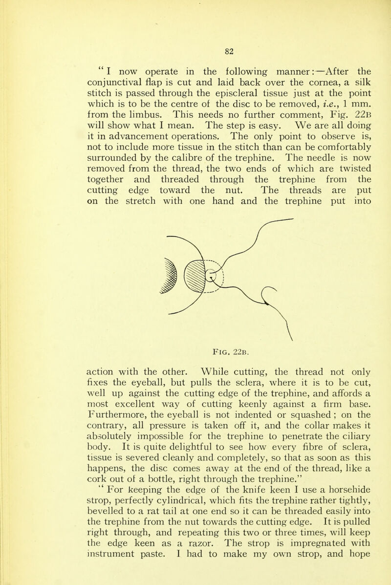  I now operate in the following manner:—After the conjunctival flap is cut and laid back over the cornea, a silk stitch is passed through the episcleral tissue just at the point which is to be the centre of the disc to be removed, i.e., 1 mm. from the limbus. This needs no further comment. Fig. 22b will show what I mean. The step is easy. We are all doing it in advancement operations. The only point to observe is, not to include more tissue in the stitch than can be comfortably surrounded by the calibre of the trephine. The needle is now removed from the thread, the two ends of which are twisted together and threaded through the trephine from the cutting edge toward the nut. The threads are put on the stretch with one hand and the trephine put into action with the other. While cutting, the thread not only fixes the eyeball, but pulls the sclera, where it is to be cut, well up against the cutting edge of the trephine, and affords a most excellent way of cutting keenly against a firm base. Furthermore, the eyeball is not indented or squashed ; on the contrary, all pressure is taken off it, and the collar makes it absolutely impossible for the trephine to penetrate the ciliary body. It is quite delightful to see how every fibre of sclera, tissue is severed cleanly and completely, so that as soon as this happens, the disc comes away at the end of the thread, like a cork out of a bottle, right through the trephine.  For keeping the edge of the knife keen I use a horsehide strop, perfectly cylindrical, which fits the trephine rather tightly, bevelled to a rat tail at one end so it can be threaded easily into the trephine from the nut towards the cutting edge. It is pulled right through, and repeating this two or three times, will keep the edge keen as a razor. The strop is impregnated with instrument paste. 1 had to make my own strop, and hope Fig. 22b.