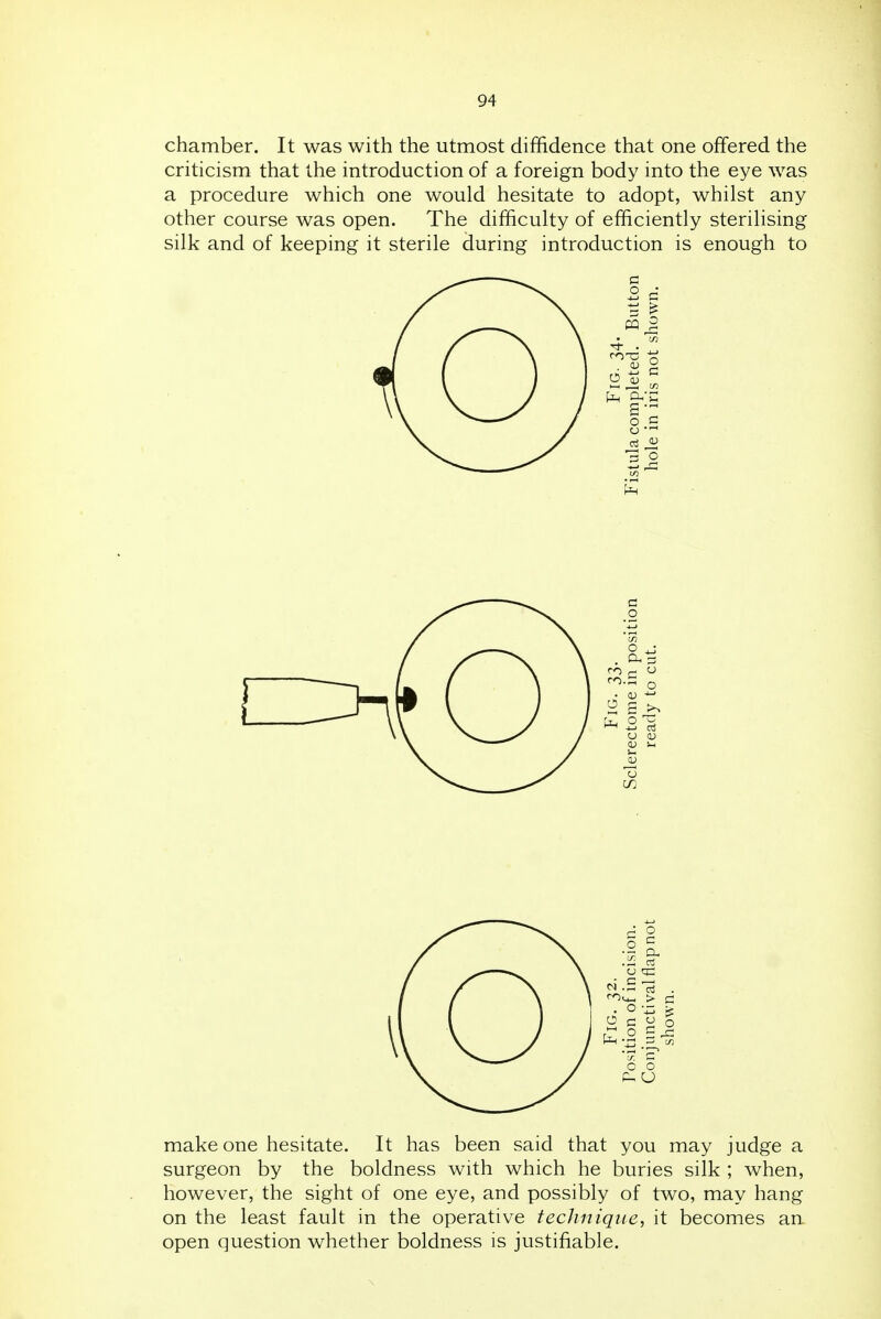 chamber. It was with the utmost diffidence that one offered the criticism that the introduction of a foreign body into the eye was a procedure which one would hesitate to adopt, whilst any other course was open. The difficulty of efficiently sterilising silk and of keeping it sterile during introduction is enough to make one hesitate. It has been said that you may judge a surgeon by the boldness with which he buries silk ; when, however, the sight of one eye, and possibly of two, may hang on the least fault in the operative technique, it becomes an open question whether boldness is justifiable.