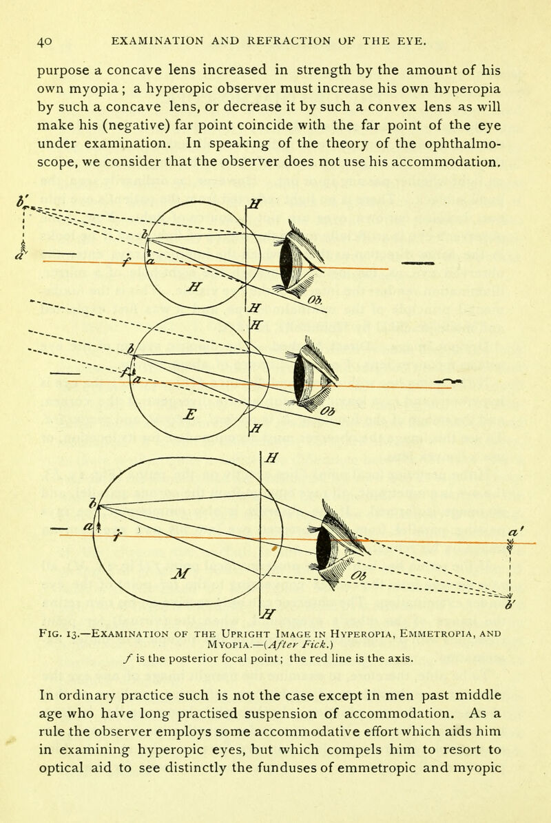 purpose a concave lens increased in strength by the amount of his own myopia; a hyperopic observer must increase his own hyperopia by such a concave lens, or decrease it by such a convex lens as will make his (negative) far point coincide with the far point of the eye under examination. In speaking of the theory of the ophthalmo- scope, we consider that the observer does not use his accommodation. In ordinary practice such is not the case except in men past middle age who have long practised suspension of accommodation. As a rule the observer employs some accommodative effort which aids him in examining hyperopic eyes, but which compels him to resort to optical aid to see distinctly the funduses of emmetropic and myopic