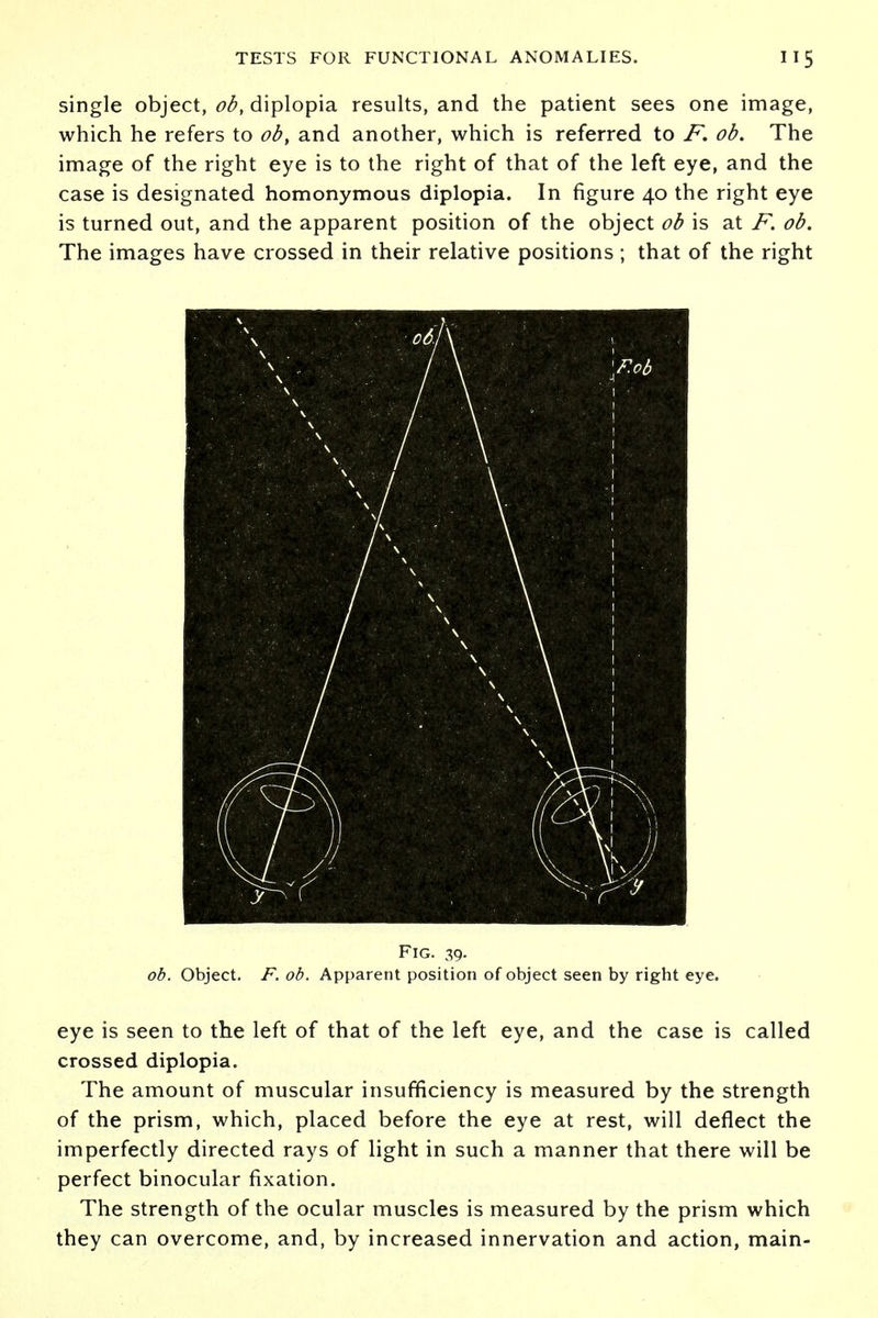 single object, ob, diplopia results, and the patient sees one image, which he refers to ob, and another, which is referred to F. ob. The image of the right eye is to the right of that of the left eye, and the case is designated homonymous diplopia. In figure 40 the right eye is turned out, and the apparent position of the object ob is at F. ob. The images have crossed in their relative positions ; that of the right Fig. 39. ob. Object. F. ob. Apparent position of object seen by right eye. eye is seen to the left of that of the left eye, and the case is called crossed diplopia. The amount of muscular insufficiency is measured by the strength of the prism, which, placed before the eye at rest, will deflect the imperfectly directed rays of light in such a manner that there will be perfect binocular fixation. The strength of the ocular muscles is measured by the prism which they can overcome, and, by increased innervation and action, main-