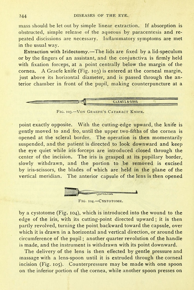 mass should be let out by simple linear extraction. If absorption is obstructed, simple release of the aqueous by paracentesis and re- peated discissions are necessary. Inflammatory symptoms are met in the usual way. Extraction with Iridectomy.—The lids are fixed by a lid-speculum or by the fingers of an assistant, and the conjunctiva is firmly held with fixation forceps, at a point centrally below the margin of the cornea. A Graefe knife (Fig. 103) is entered at the corneal margin, just above its horizontal diameter, and is passed through the an- terior chamber in front of the pupil, making counterpuncture at a Fig. 103.—Von Graefe's Cataract Knife. point exactly opposite. With the cutting-edge upward, the knife is gently moved to and fro, until the upper two-fifths of the cornea is opened at the scleral border. The operation is then momentarily suspended, and the patient is directed to look downward and keep the eye quiet while iris-forceps are introduced closed through the center of the incision. The iris is grasped at its pupillary border, slowly withdrawn, and the portion to be removed is excised by iris-scissors, the blades of which are held in the plane of the vertical meridian. The anterior capsule of the lens is then opened Fig. 104.—Cystotome. by a cystotome (Fig. 104), which is introduced into the wound to the edge of the iris, with its cutting-point directed upward ; it is then partly revolved, turning the point backward toward the capsule, over which it is drawn in a horizontal and vertical direction, or around the circumference of the pupil; another quarter revolution of the handle is made, and the instrument is withdrawn with its point downward. The delivery of the lens is then effected by gentle pressure and massage with a lens-spoon until it is extruded through the corneal incision (Fig. 105). Counterpressure may be made with one spoon on the inferior portion of the cornea, while another spoon presses on