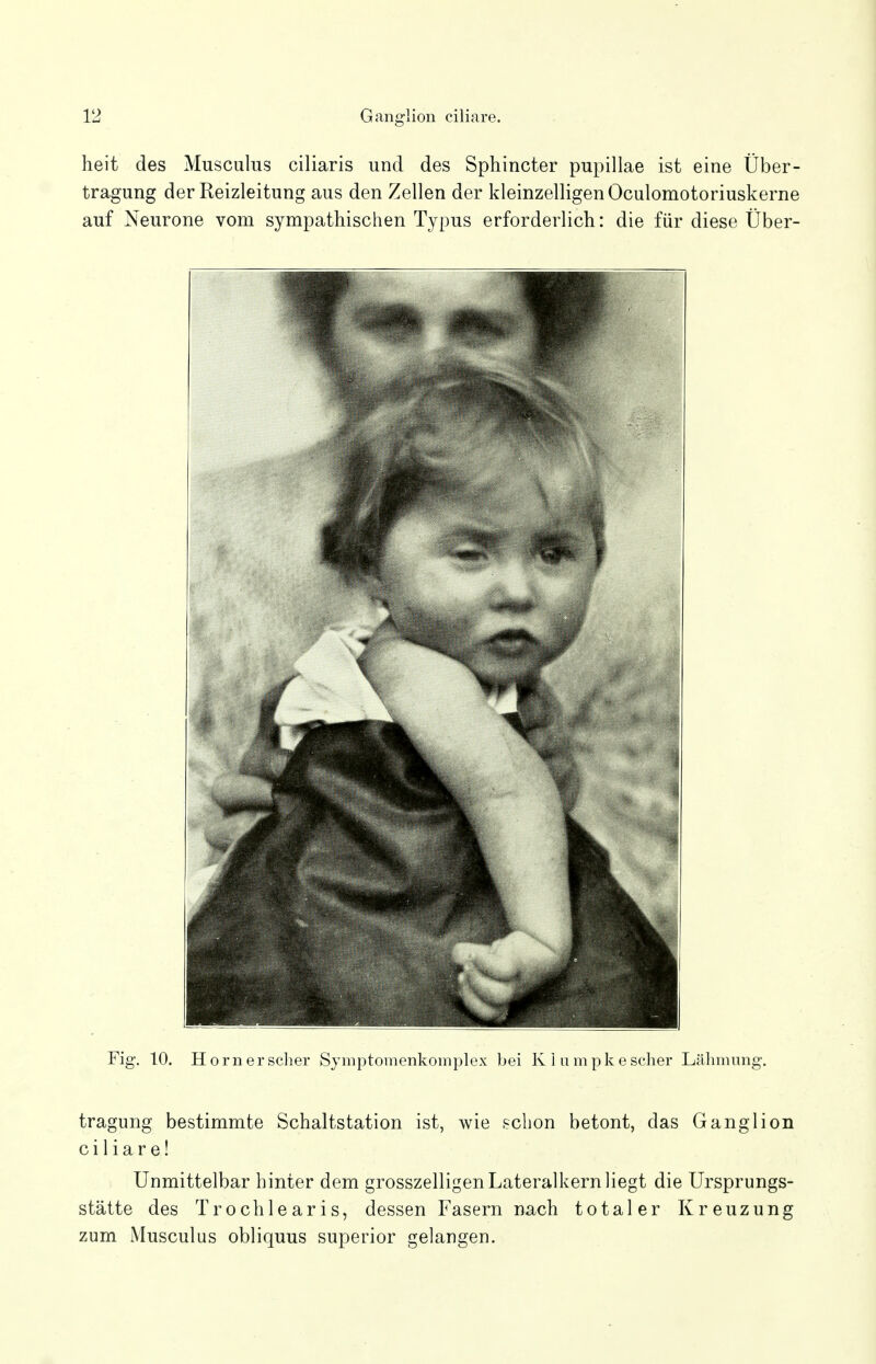 heit des Musculus ciliaris und des Sphincter pupillae ist eine Über- tragung der Reizleitung aus den Zellen der kleinzelligen Oculomotoriuskerne auf Neurone vom sympathischen Typus erforderlich: die für diese Über- Fig. 10. Hörner scher Symptomenkomplex bei K i umpke scher Lähmung. tragung bestimmte Schaltstation ist, wie schon betont, das Ganglion ciliare! Unmittelbar hinter dem grosszelligen Lateralkern liegt die Ursprungs- stätte des Trochlearis, dessen Fasern nach totaler Kreuzung zum Musculus obliquus superior gelangen.