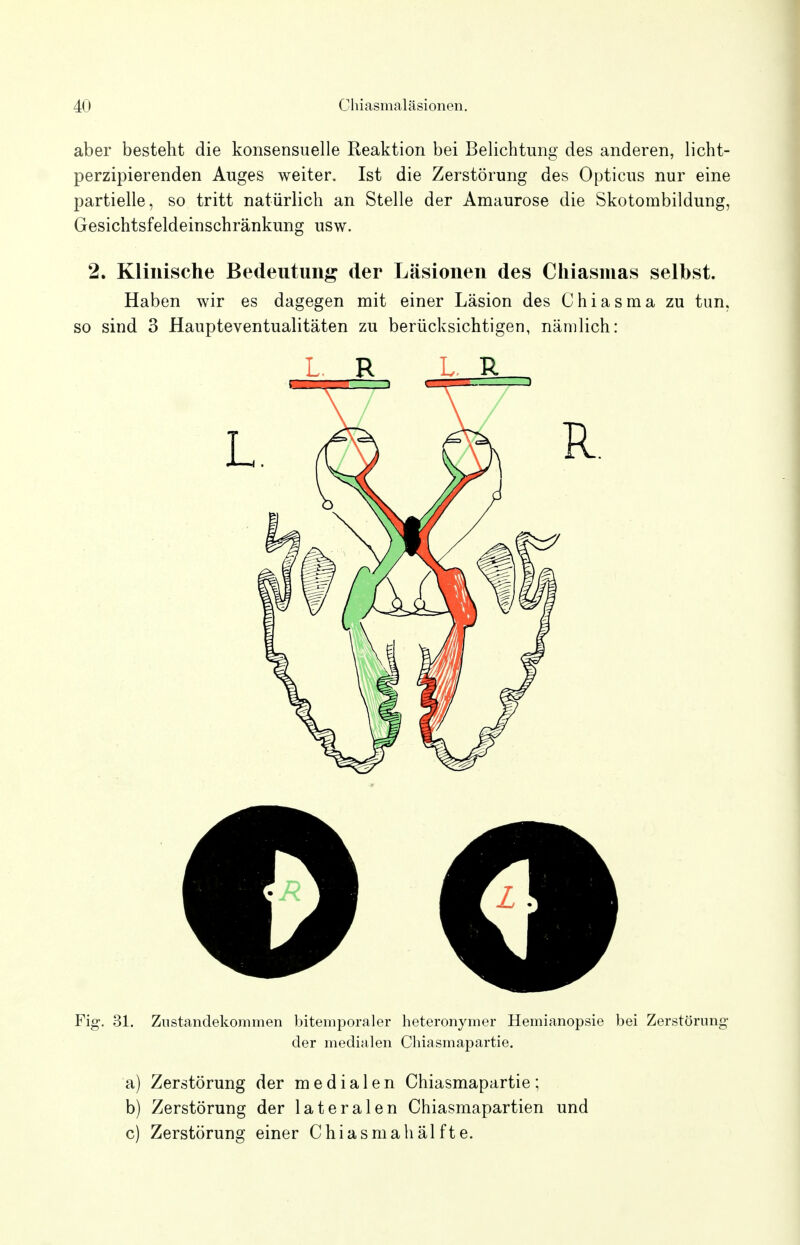 aber besteht die konsensuelle Reaktion bei Belichtung des anderen, licht- perzipierenden Auges weiter. Ist die Zerstörung des Opticus nur eine partielle, so tritt natürlich an Stelle der Amaurose die Skotombildung, Gesichtsfeldeinschränkung usw. 2. Klinische Bedeutung der Läsionen des Chiasmas selbst. Haben wir es dagegen mit einer Läsion des Chiasma zu tun. so sind 3 Haupteventualitäten zu berücksichtigen, nämlich: Fig. 31. Znstandekommen bitemporaler heteronymer Hemianopsie bei Zerstörung der medialen Chiasmapartie. a) Zerstörung der medialen Chiasmapartie; b) Zerstörung der lateralen Chiasmapartien und c) Zerstörung einer Chiasmahälfte. L. R LR