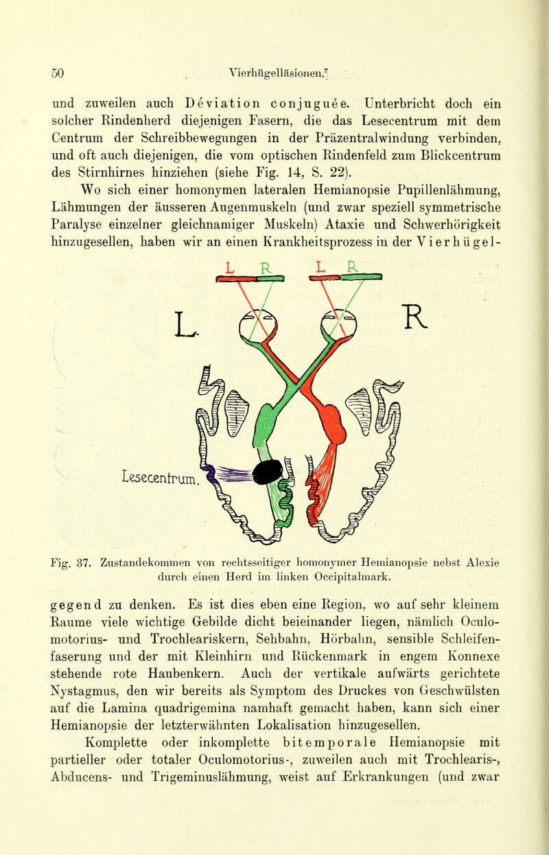 und zuweilen auch Deviation conjuguee. Unterbricht doch ein solcher Kindenherd diejenigen Fasern, die das Lesecentrum mit dem Centrum der Schreibbewegungen in der Präzentralwindung verbinden, und oft auch diejenigen, die vom optischen Rindenfeld zum Blickcentrum des Stirnhirnes hinziehen (siehe Fig. 14, S. 22). Wo sich einer homonymen lateralen Hemianopsie Pupillenlähmung, Lähmungen der äusseren Augenmuskeln (und zwar speziell symmetrische Paralyse einzelner gleichnamiger Muskeln) Ataxie und Schwerhörigkeit hinzugesellen, haben wir an einen Krankheitsprozess in der Vierhügel- LR L Fig. 37. Zustandekommen von rechtsseitiger homonymer Hemianopsie nebst Alexie durch einen Herd im linken Occipitalmark. gegen d zu denken. Es ist dies eben eine Region, wo auf sehr kleinem Räume viele wichtige Gebilde dicht beieinander liegen, nämlich Oculo- motorius- und Trochleariskern, Sehbahn, Hörbahn, sensible Schleifen- faserung und der mit Kleinhirn und Rückenmark in engem Konnexe stehende rote Haubenkern. Auch der vertikale aufwärts gerichtete Nystagmus, den wir bereits als Symptom des Druckes von Geschwülsten auf die Lamina quadrigemina namhaft gemacht haben, kann sich einer Hemianopsie der letzterwähnten Lokalisation hinzugesellen. Komplette oder inkomplette bitemporale Hemianopsie mit partieller oder totaler Oculomotorius-, zuweilen auch mit Trochlearis-, Abducens- und Trigeminuslähmung, weist auf Erkrankungen (und zwar