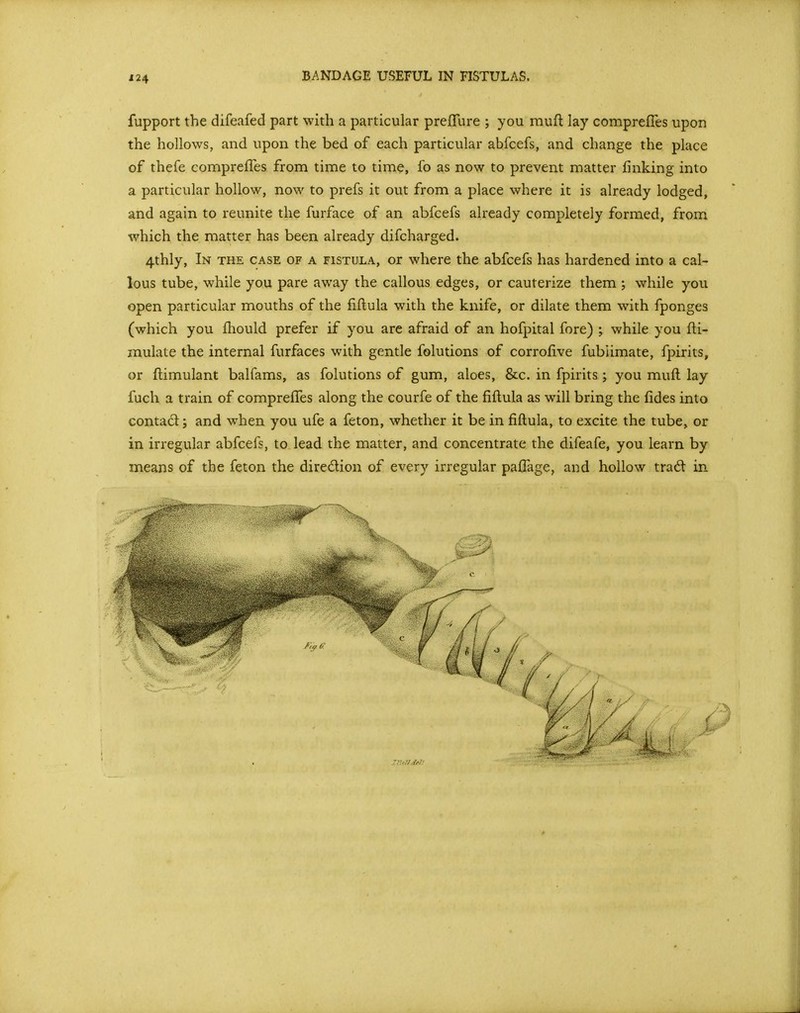 BANDAGE USEFUL IN FISTULAS. fupport the difeafed part with a particular prefTure ; you muft lay comprefles upon the hollows, and upon the bed of each particular abfcefs, and change the place of thefe compreffes from time to time, fo as now to prevent matter linking into a particular hollow, now to prefs it out from a place where it is already lodged, and again to reunite the furface of an abfcefs already completely formed, from which the matter has been already difcharged. 4thly, In the case of a fistula, or where the abfcefs has hardened into a cal- lous tube, while you pare away the callous edges, or cauterize them ; while you open particular mouths of the fiflula with the knife, or dilate them with fponges (which you fhould prefer if you arc afraid of an hofpital fore) ; while you fti- mulate the internal furfaces with gentle folutions of corrofive fublimate, fpirits, or flimulant balfams, as folutions of gum, aloes, &c. in fpirits ; you muft lay fuch a train of compreffes along the courfe of the fiflula as will bring the fides into contad; and when you ufe a feton, whether it be in fiflula, to excite the tube, or in irregular abfcefs, to lead the matter, and concentrate the difeafe, you learn by means of the feton the diredion of every irregular pafTage, and hollow trad in