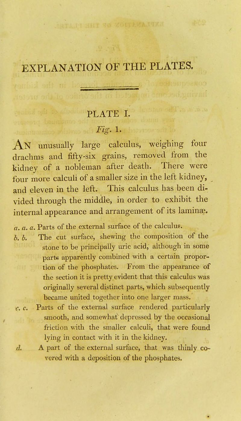 EXPLANATION OF THE PLATES. PLATE I. Fig. 1. An unusually large calculus, weighing four drachms and fifty-six grains, removed from the kidney of a nobleman after death. There were four more calculi of a smaller size in the left kidney, and eleven in the left. This calculus has been di- vided through the middle, in order to exhibit the internal appearance and arrangement of its lamina. a. a. a. Parts of the external surface of the calculus. b. b. The cut surface, shewing the composition of the stone to be principally uric acid, although in some parte apparently combined with a certain propor- tion of the phosphates. From the appearance of the section it is pi*etty evident that this calculus was originally several distinct parts, which subsequently became united together into one larger mass. r. c. Parts of the external surface rendered particularly smooth, and somewhat^ depressed by the occasional friction vvith the smaller calculi, that were found lying in contact with it in the kidney. d. A part of the external surface, that was thinly co- vered with a deposition of the phosphates.
