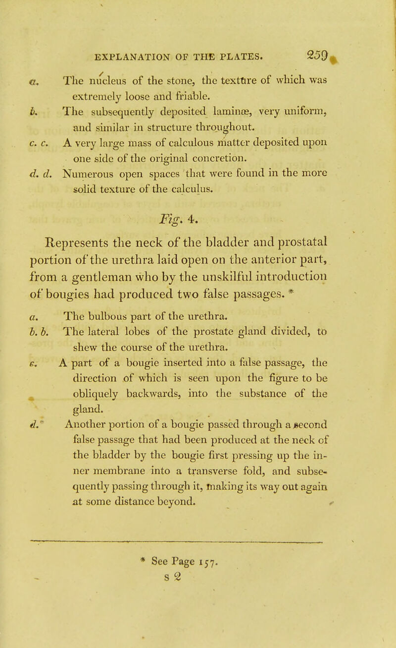 c. The nucleus of the stone, the texttire of which was extremely loose and friable. b. The subsequently deposited laminee, very uniform, and similar in structure throughout. c. c. A very large mass of calculous matter deposited upon one side of the original concretion. </. d. Numerous open spaces that were found in the more solid texture of the calculus. Fig, 4. Represents the neck of the bladder and prostatal portion of the urethra laid open on the anterior part, from a gentleman who by the unskilful introduction of bougies had produced two false passages. * a. The bulbous part of the urethra. b. b. The lateral lobes of the prostate gland divided, to shew the course of the urethra. g, A part of a bougie inserted into a false passage, the direction .of which is seen upon the figure to be ^ obliquely backwards, into the substance of the gland. d.  Another portion of a bougie passed through a second false passage that had been produced at the neck of the bladder by the bougie first pressing up the in- ner membrane into a transverse fold, and subse- quently passing through it, making its way out again at some distance beyond. <• See Page 157. S 2
