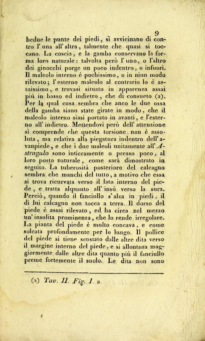 hedue le punte dei piedi, sì avvicinano di con- tro r una all'altra, talmente che quasi si toc- cano. La coscia 5 e la gamba conservano la for- ma loro naturale: talvolta però Tuno, o l'altro dei ginocchi porge un poco indentro, o infuori. Il maleolo interno è pochissimo, o in niiin modo rilevato; f esterno maleolo al contrario lo è as- saissimo , e trovasi situato in apparenza assai più in basso ed indietro , che di consueto (a). Per 1^ qual cosa sembra che anco le due ossa della gamba siano state girate in modo, che il maleolo interno siasi portato in avanti, e l'ester- no all' indietro. Mettendovi però dell' attenzione si comprende che questa torsione non è asso- luta , ma relativa alla piegatura indentro dell'a- vanpiede^ e che i due maleoli unitamente all'^- stragalo sono intieramente o presso poco ^ al loro posto naturale, come sarà dimostrato in seguito. La tuberosità posteriore del calcagno sembra che manchi del tutto, a motivo che essa si trova ricurvc-^ta verso il lato interno del pie- de , e tratta alquanto all' insù verso la sura. Perciò, quando il fanciullo s'alza in piedi, il di lui calcagno non tocca a terra. Il dorso del piede è assai rilevato , ed ha circa nel mezzo un'insolita prominenza, che lo rende irregolare, lia pianta del piede è molto concava , e come solcata profondamente per lo lungo. Il pollice del piede si tiene scostato dalle altre dita verso il margine interno del piede, e si allontana mag- giormente dalle altre dita quanto più il fanciullo preme fortemente il suolo. Le dita non sono (a) Tav, JL Fig. I B.