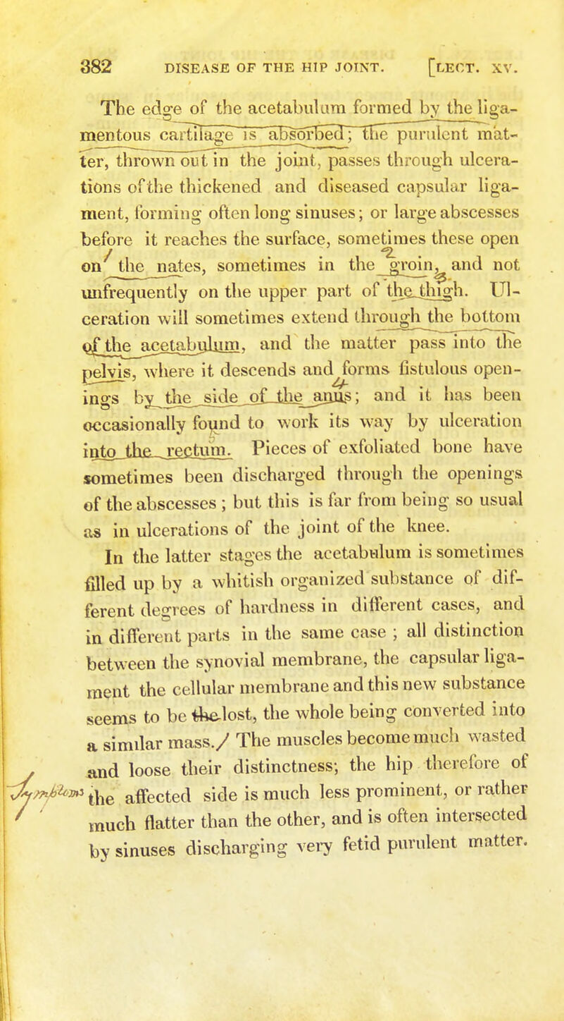 The edge of the acetabulum formed bythe liga- mentous cartilage is^BsorbeoTptrie- purulent mat- ter, thrown out in the joint, passes through ulcera- tions of the thickened and diseased capsular liga- ment, forming often long sinuses; or large abscesses before it reaches the surface, sometimes these open on^the^jiates, sometimes in the groin^ and not unfrequently on the upper part of the_thigh. Ul- ceration will sometimes extend through the bottom ojQheju^eiatm^ and the matter pass into the pelvis, where it descends and forms fistulous open- ings by_the__s^_piJiigjmjis; and it has been occasionally found to work its way by ulceration injojiie_j£ciuni1 Pieces of exfoliated bone have sometimes been discharged through the openings of the abscesses; but this is far from being so usual as in ulcerations of the joint of the knee. In the latter stages the acetabulum is sometimes filled up by a whitish organized substance of dif- ferent decrees of hardness in different cases, and in different parts in the same case ; all distinction between the synovial membrane, the capsular liga- ment the cellular membrane and this new substance seems to be the-lost, the whole being converted into a similar mass./ The muscles become much wasted , and loose their distinctness; the hip therefore of t]ie affected side is much less prominent, or rather ' much flatter than the other, and is often intersected by sinuses discharging very fetid purulent matter.