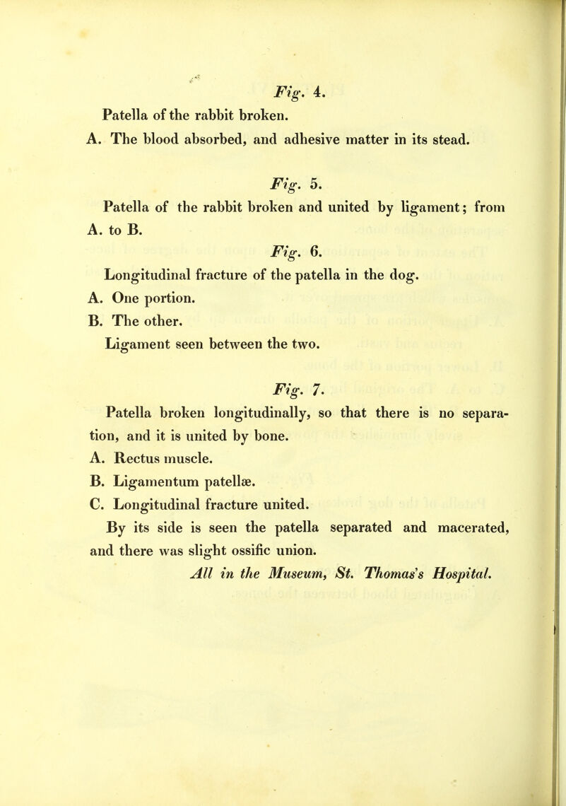 Fig. 4. Patella of the rabbit broken. A. The blood absorbed, and adhesive matter in its stead. Fig. 5. Patella of the rabbit broken and united by ligament; from A. to B. Fig. 6. Longitudinal fracture of the patella in the dog. A. One portion. B. The other. Ligament seen between the two. Fig. 7. Patella broken longitudinally, so that there is no separa- tion, and it is united by bone. A. Rectus muscle. B. Ligamentum patellae. C. Longitudinal fracture united. By its side is seen the patella separated and macerated, and there was slight ossific union. All in the Museum, St. Thomas's Hospital.