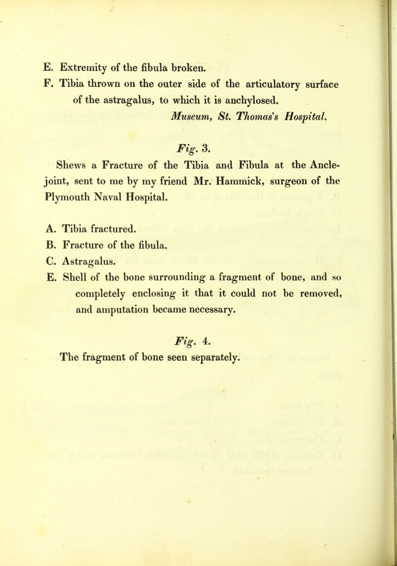 E. Extremity of the fibula broken. F. Tibia thrown on the outer side of the articulatory surface of the astragalus, to which it is anchylosed. Museum, St. Thomas's Hospital, Fig. 3. Shews a Fracture of the Tibia and Fibula at the Ancle- joint, sent to me by my friend Mr. Hammick, surgeon of the Plymouth Naval Hospital. A. Tibia fractured. B. Fracture of the fibula. C. Astragalus. E. Shell of the bone surrounding a fragment of bone, and so completely enclosing it that it could not be removed, and amputation became necessary. Fig. i. The fragment of bone seen separately.