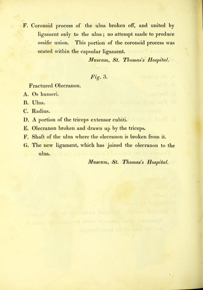 F. Coronoid process of the ulna broken off, and united by ligament only to the ulna; no attempt made to produce ossific union. This portion of the coronoid process was seated within the capsular ligament. Museum, St. Thomas's Hospital. Fig. 3. Fractured Olecranon. A. Os humeri. B. Ulna. C. Radius. D. A portion of the triceps extensor cubiti. E. Olecranon broken and drawn up by the triceps. F. Shaft of the ulna where the olecranon is broken from it. G. The new ligament, which has joined the olecranon to the ulna.