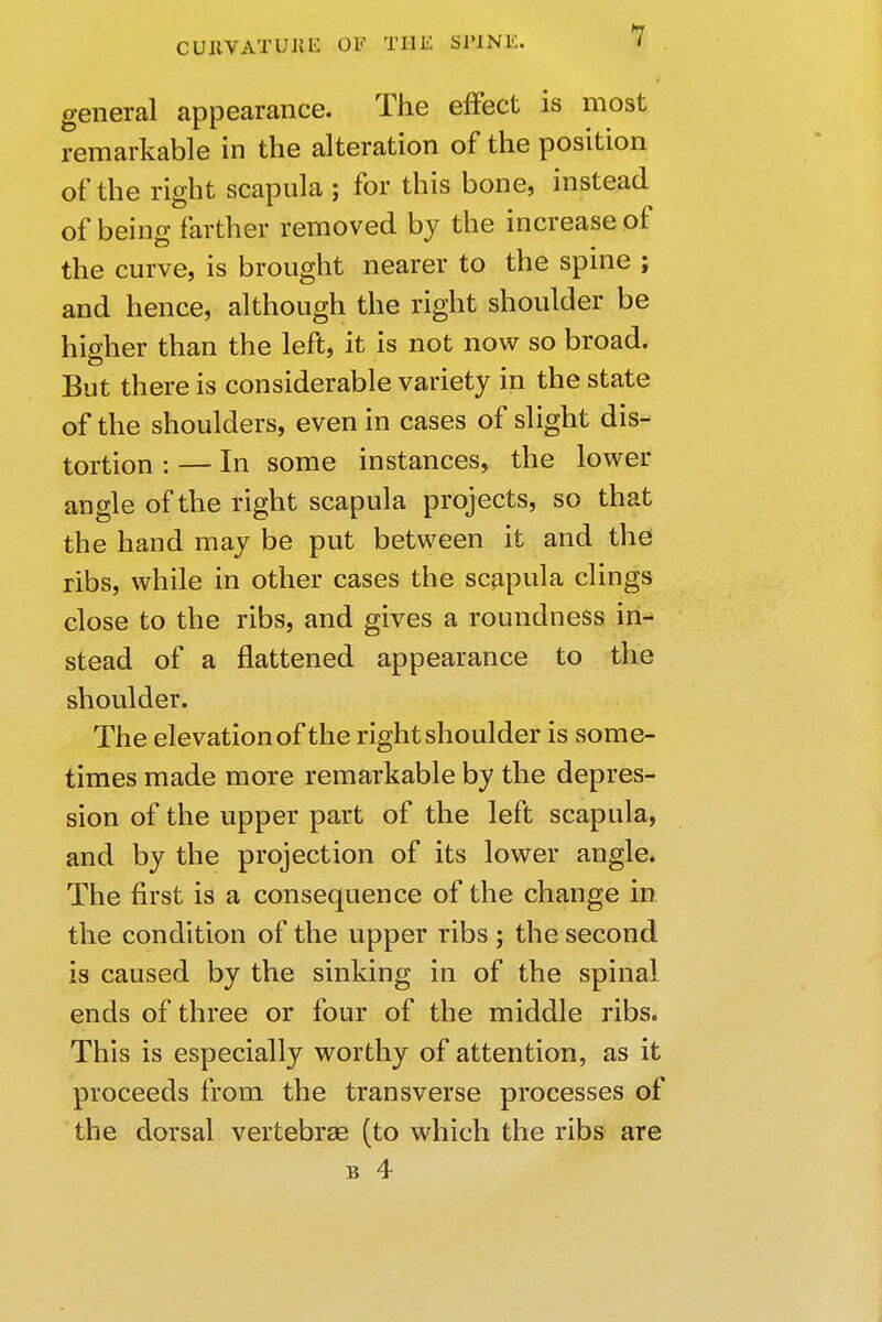 general appearance. The effect is most remarkable in the alteration of the position of the right scapula ; for this bone, instead of being farther removed by the increase of the curve, is brought nearer to the spine ; and hence, although the right shoulder be higher than the left, it is not now so broad. But there is considerable variety in the state of the shoulders, even in cases of slight dis- tortion : — In some instances, the lower angle of the right scapula projects, so that the hand may be put between it and the ribs, while in other cases the scapula clings close to the ribs, and gives a roundness in- stead of a flattened appearance to the shoulder. The elevation of the right shoulder is some- times made more remarkable by the depres- sion of the upper part of the left scapula, and by the projection of its lower angle. The first is a consequence of the change in the condition of the upper ribs ; the second is caused by the sinking in of the spinal ends of three or four of the middle ribs. This is especially worthy of attention, as it proceeds from the transverse processes of the dorsal vertebrae (to which the ribs are