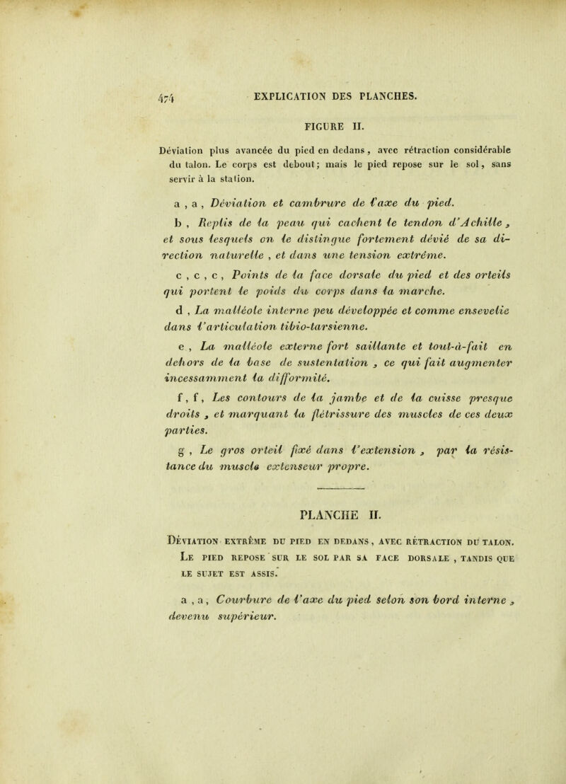 FIGURE II. Deviation plus avancee du pied en dedans , avcc retraction considerable du talon. Le corps est debout; mais le pied repose sur le sol, sans servir a la station. a , a , Deviation et cambrure de Vaxe du pied. b , Repiis de la peau qui cachent le tendon d'Achille , et sous lesqueis on le distingue fortement devie de sa di- rection natureUe , et dans une tension extreme. c , c , c , Points de la face dorsale du pied et des orteils qui portent le poids du corps dans la marche. d , La maUeole interne peu developpee et comme enseveiie dans I'articulation tibio-tarsienne. e , La maUeole externe fort saillante et tout-d-fait en dehors de la base de susteniation , ce qui fait augmenter incessamment la difformite. f, f, Les contours de la jambe et de la cuisse presqxie droits , et mar quant la fletrissure des muscles de ces deux parties. g , Le gros orteil fix6 dans I'extension s par la resis- tance du muscle cxtenseur propre. PLANCHE N. Deviation extreme du pied en dedans, avec retraction du talon. Le pied repose sur le sol par sa face dorsale , tandis que le sujet est assis. a , a , Courbure de I'axe du pied selon son bord interne 3 devenu superieur.