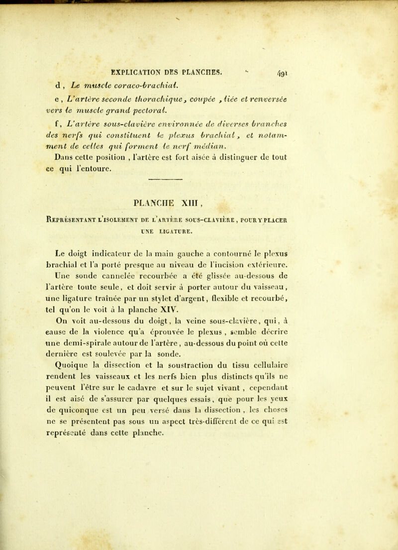 d , Le muscle coraco-brachial. e, L'artere seconde thorachique t coupce ,liee et renversee vers le muscle grand pectoral. f, L'artere sous-clavicre environnee de diverse* branches des nerfs qui constituent ie plexus brachial, et nolam- ment de celles qui forment le nerf median. Dans cette position , l'artere est fort aisee a distinguer de tout ee qui l'entoure. PLANCHE XIII, REPRESENTANT L'iSOLEMENT DE L'ARTERE SOUS-CLAVIERE , POUR Y PLACER ENE LIGATURE. Le doigt indicateur de la main gauche a contourne Ie plexus brachial et l'a porle presque au niveau de l'iucision exterieure. Une sonde cannelee rccourbee a ete glissee au-dessous de l'artere toute seule, et doit servir a porter autour du vaisseau, une ligature trainee par un stylet d'argent, flexible et recourbe, tel qu'on le voit a la planche XIV. On voit au-dessous du doigt, la veine sous-clavicre, qui, a eause de la violence qua eprouvee le plexus , semble decrire une demi-spirale autour de l'artere, au-dessous du point ou celte derniere est soulcvee par la sonde. Quoique la dissection et la soustraction du tissu ceHulaire rendent les vaisseaux et les nerfs bicn plus dislincts qu'ils ne peuvent l'etre sur le cadavre et sur le sujet vivant , cependant il est aise de s'assurcr par quelques essais, que pour les yeux de quiconque est un peu verse dans la dissection , les choses ne se presentent pas sous un aspect tres-difiercnt de ce qui est represeiile dans cette planche.
