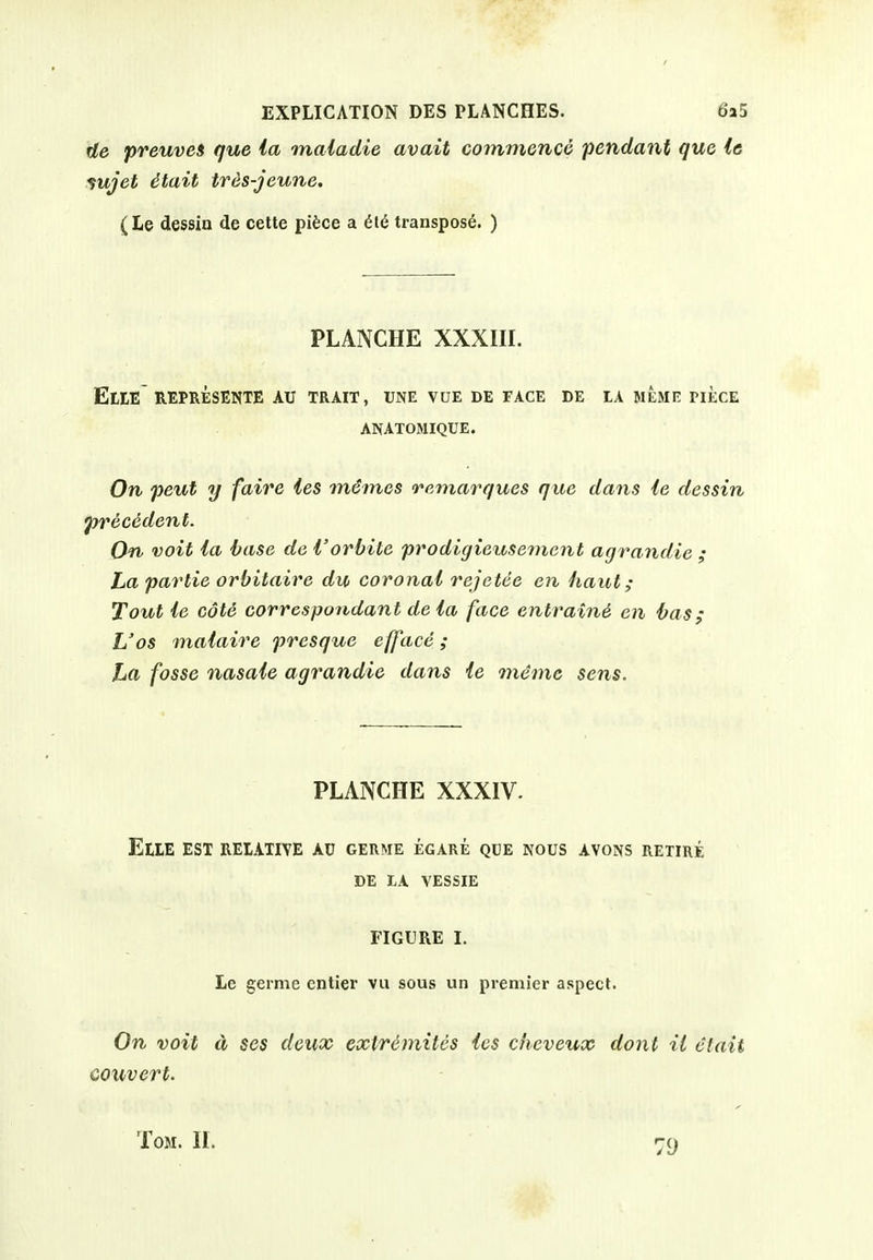 Ue preuves que la maiadie avail commence pendant que le ^ujet dtait tres-jeune. (Le dessin de cette pifece a transpose. ) PLANCHE XXXIII. EtlE REPRESENTE AU TRAIT, UNE VUE DE FACE DE lA MEME PIECE ANATOMIQUE. On peut y faire ies memos remarques que dans ie dessin precident. On voit la base de I'orbite prodlgieusement agrandie ; La partie orbilaire du coronal rejetee en haut; Tout le cote correspondant de la face entraini en bas; L'os malaire presque efface; La fosse nasale agrandie dans le mdmc sens. PLANCHE XXXIV. EUE EST REIATIYE AU GERME EGARE QUE NOUS AVONS RETIRE DE LA VESSIE FIGURE I. Le germe entier vu sous un premier aspect. On voit d ses deux extr6mites ies cheveu^x dont it elait couvert. Tom. 11. -o