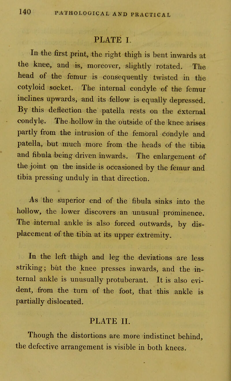 PLATE I. In the first print, the right thigh is bent inwards at the knee, and is, moreover, slightly rotated. The head of the femur is consequently twisted in the cotyloid socket. The internal condyle of the femur inclines upwards, and its fellow is equally depressed. By this deflection the patella rests on the External condyle. The hollow in the outside of the knee arises partly from the intrusion of the femoral condyle and patella, but much more from the heads of the tibia and fibula being driven inwards. The enlargement of the joint on the inside is occasioned by the femur and tibia pressing unduly in that direction. As the superior end of the fibula sinks into the hollow, the lower discovers an unusual prominence. The internal ankle is also forced outwards, by dis- placement of the tibia at its upper extremity. In the left thigh and leg the deviations are less striking; but the knee presses inwards, and the in- ternal ankle is unusually protuberant. It is also evi- dent, fi*ora the turn of the foot, that this ankle is partially dislocated. PLATE II. Though the distortions are more indistinct behind, the defective arrangement is visible in both knees.