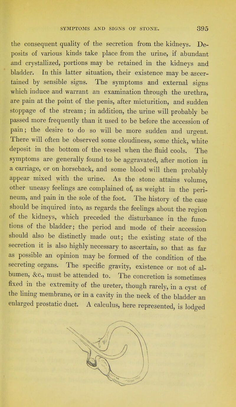 the consequent quality of the secretion from the kidneys. De- posits of various kinds take place from the urine, if abundant and crystallized, portions may be retained in the kidneys and bladder. En this latter situation, their existence may be ascer- tained by sensible signs. The symptoms and external signs which induce and warrant an examination through the urethra, are pain at the point of the penis, after micturition, and sudden stoppage of the stream; in addition, the urine will probably be passed more frequently than it used to be before the accession of pain; the desire to do so will be more sudden and urgent. There will often be observed some cloudiness, some thick, white deposit in the bottom of the vessel when the fluid cools. The symptoms are generally found to be aggravated, after motion in a carriage, or on horseback, and some blood will then probably appear mixed with the urine. As the stone attains volume, other uneasy feelings are complained of, as weight in the peri- neum, and pain in the sole of the foot. The history of the case should be inquired into, as regards the feelings about the region of the kidneys, which preceded the disturbance in the func- tions of the bladder; the period and mode of their accession should also be distinctly made out; the existing state of the secretion it is also highly necessary to ascertain, so that as far as possible an opinion may be formed of the condition of the secreting organs. The specific gravity, existence or not of al- bumen, &c, must be attended to. The concretion is sometimes fixed in the extremity of the ureter, though rarely, in a cyst of the lining membrane, or in a cavity in the neck of the bladder an enlarged prostatic duct. A calculus, here represented, is lodged