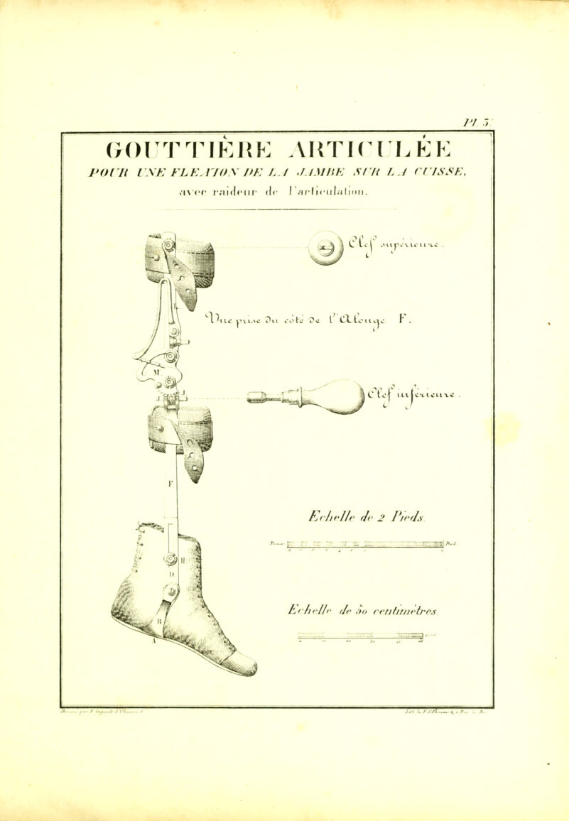 /y j GOUTTIÈRE ARTICULÉE POUR UNE FLEA70NDE LA JAMBE SUR LA CUISSE', avec raideur <!<• I aHieuialjoTi. ZE /■■■ rty * TofïZ.