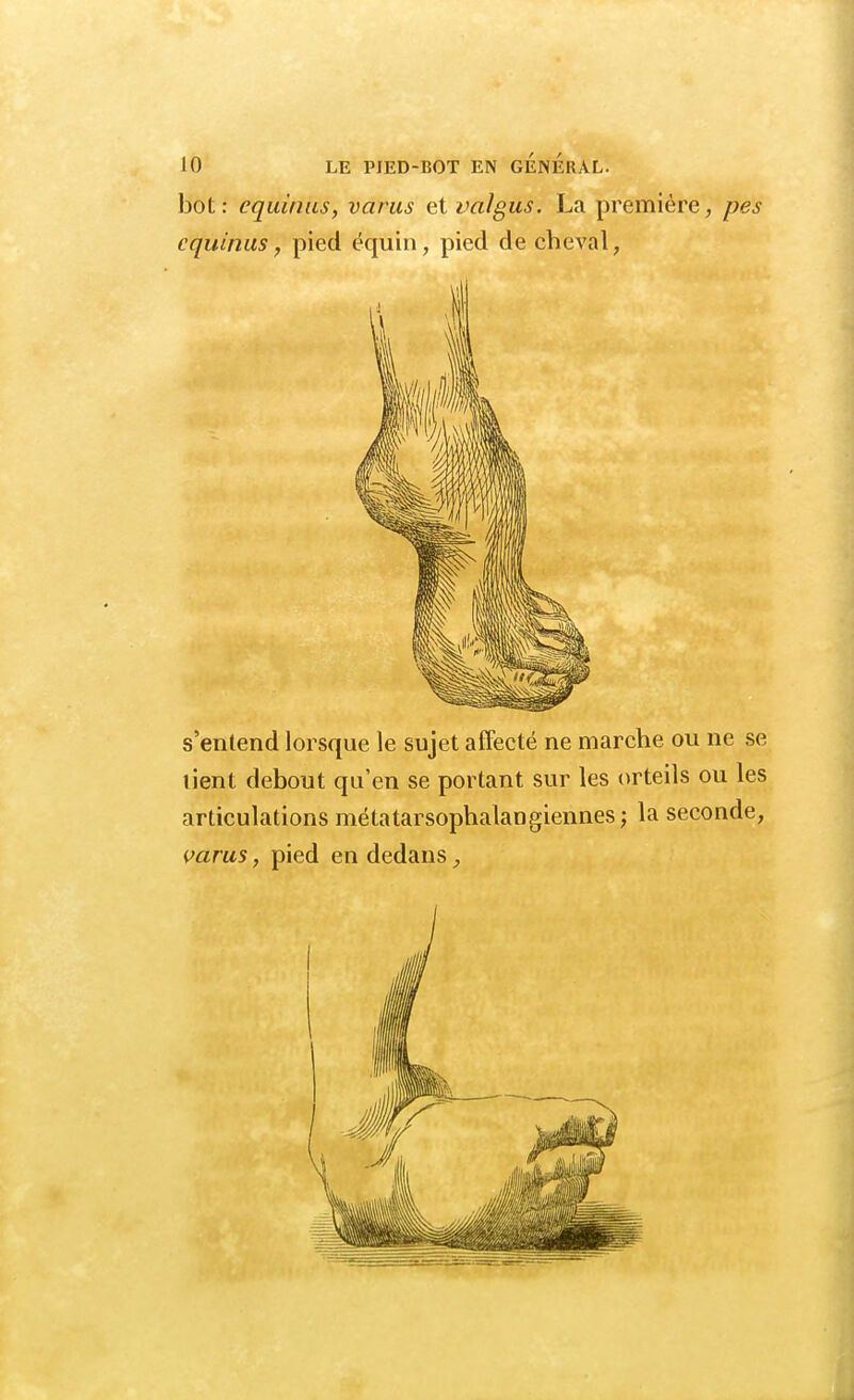 bot: cquinus, varus et valgus. La première, pes cquinus, pied équin, pied de cheval, s'entend lorsque le sujet affecté ne marche ou ne se lient debout qu'en se portant sur les orteils ou les articulations métatarsophalangiennes; la seconde, varus, pied en dedans,