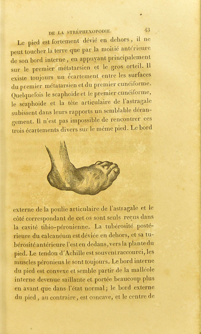 Le pied est fortement dévié en dehors , il ne peut toucher la terre que par la moitié antérieure de son bord interne, en appuyant principalement sur le premier métatarsien et le gros orteil. Il existe toujours un écartement entre les surfaces du premier métatarsien et du premier cunéiforme. Quelquefois le scaphoïde et le premier cunéiforme, le scaphoïde et la tête articulaire de l'astragale subissent dans leurs rapports un semblable déran- gement. Il n'est pas impossible de rencontrer ces trois écarlements divers sur le même pied. Le bord externe de la poulie articulaire de l'astragale et le côté correspondant de cet os sont seuls reçus dans la cavité tibio-péronienne. La tubérosité posté- rieure du calcanéum est déviée en dehors, et sa tu- bérosité antérieure l'esten dedans,vers la plantedu pied. Le tendon d'Achille est souvent raccourci, les muscles péroniens le sont toujours. Le bord interne du pied est convexe et semble partir de la malléole interne devenue saillante et portée beaucoup plus en avant que dans l'état normal ; le bord externe du pied , au contraire, est concave, et le centre de