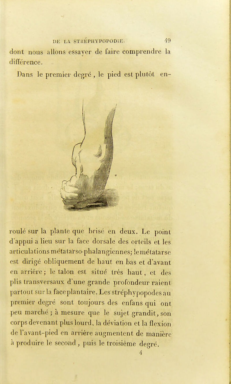 dont nous allons essayer de faire comprendre la différence. Dans le premier degré , le pied est plutôt en- roulé sur la plante que brisé en deux. Le point d'appui a lieu sur la face dorsale des orteils et les articulations métatarso-phalangiennes; lemétatarse est dirigé obliquement de haut en bas et d'avant en arrière; le talon est situé très haut, et des plis transversaux d'une grande profondeur raient partout sur la face plantaire. Les stréphypopodes au premier degré sont toujours des enfans qui ont peu marché; à mesure que le sujet grandit, son corps devenant plus lourd, la déviation et la flexion de l'avant-pied en arrière augmentent de manière à produire le second , puis le troisième degré. A