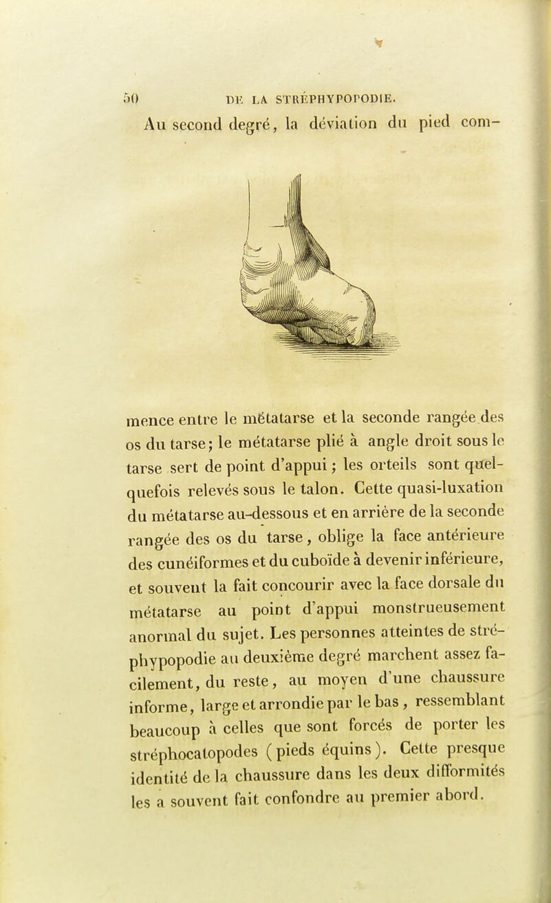 mence entre le métatarse et la seconde rangée des os du tarse; le métatarse plié à angle droit sous le tarse sert de point d'appui ; les orteils sont quel- quefois relevés sous le talon. Cette quasi-luxation du métatarse au-dessous et en arrière de la seconde rangée des os du tarse, oblige la face antérieure des cunéiformes et du cuboïde à devenir inférieure, et souvent la fait concourir avec la face dorsale du métatarse au point d'appui monstrueusement anormal du sujet. Les personnes atteintes de stré- phypopodie au deuxième degré marchent assez fa- cilement, du reste, au moyen dune chaussure informe, large et arrondie par le bas, ressemblant beaucoup à celles que sont forcés de porter les stréphocalopodes (pieds équins). Cette presque identité de la chaussure dans les deux difformités les a souvent fait confondre au premier abord.