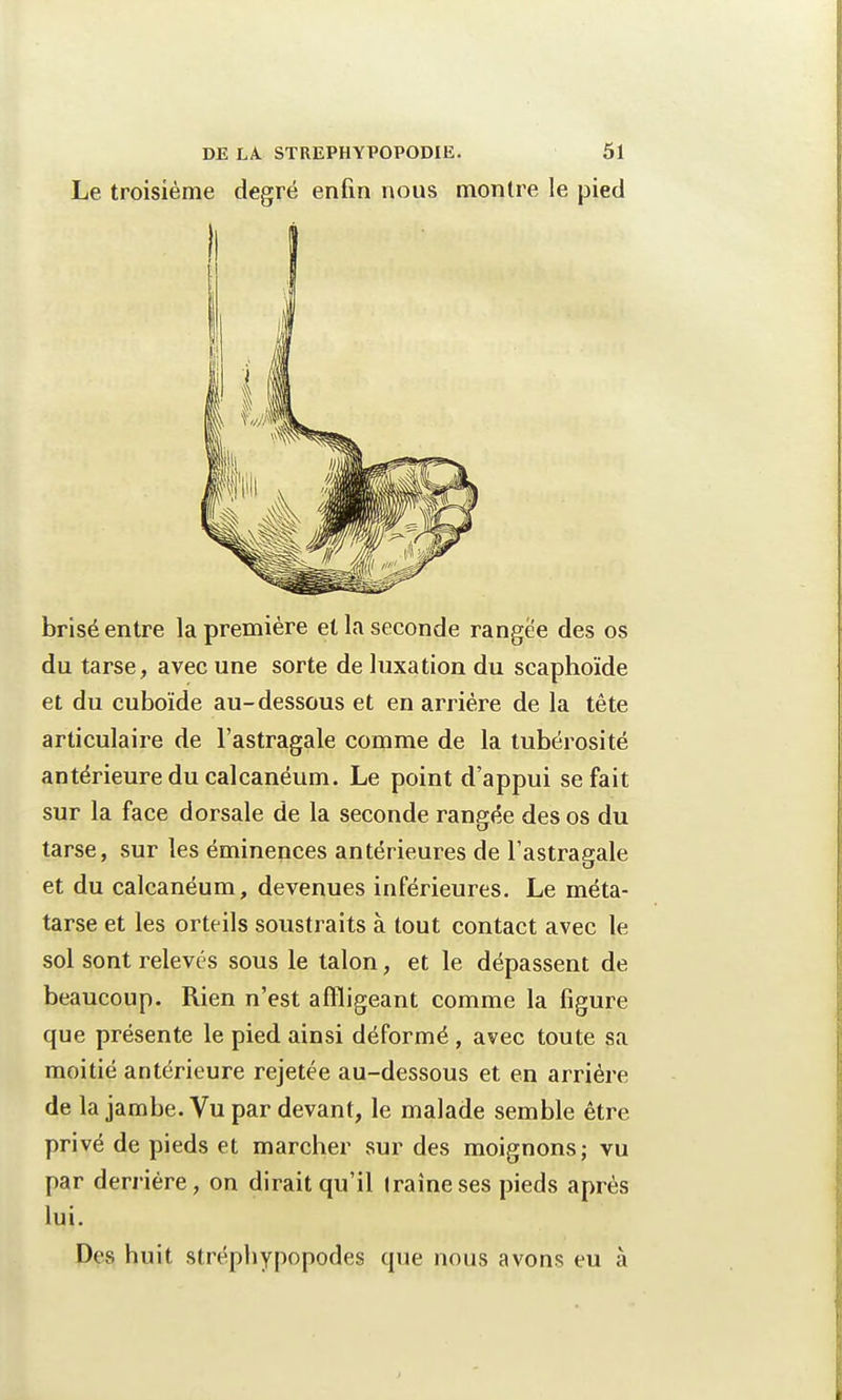 Le troisième degré enfin nous montre le pied brisé entre la première et la seconde rangée des os du tarse, avec une sorte de luxation du scaphoïde et du cuboïde au-dessous et en arrière de la tête articulaire de l'astragale comme de la tubérosité antérieure du calcanéum. Le point d'appui se fait sur la face dorsale de la seconde rangée des os du tarse, sur les éminences antérieures de l'astragale et du calcanéum, devenues inférieures. Le méta- tarse et les orteils soustraits à tout contact avec le sol sont relevés sous le talon, et le dépassent de beaucoup. Rien n'est affligeant comme la figure que présente le pied ainsi déformé , avec toute sa moitié antérieure rejetée au-dessous et en arrière de la jambe. Vu par devant, le malade semble être privé de pieds et marcher sur des moignons; vu par derrière, on dirait qu'il (raineses pieds après lui. Des huit stréphypopodes que nous avons eu à