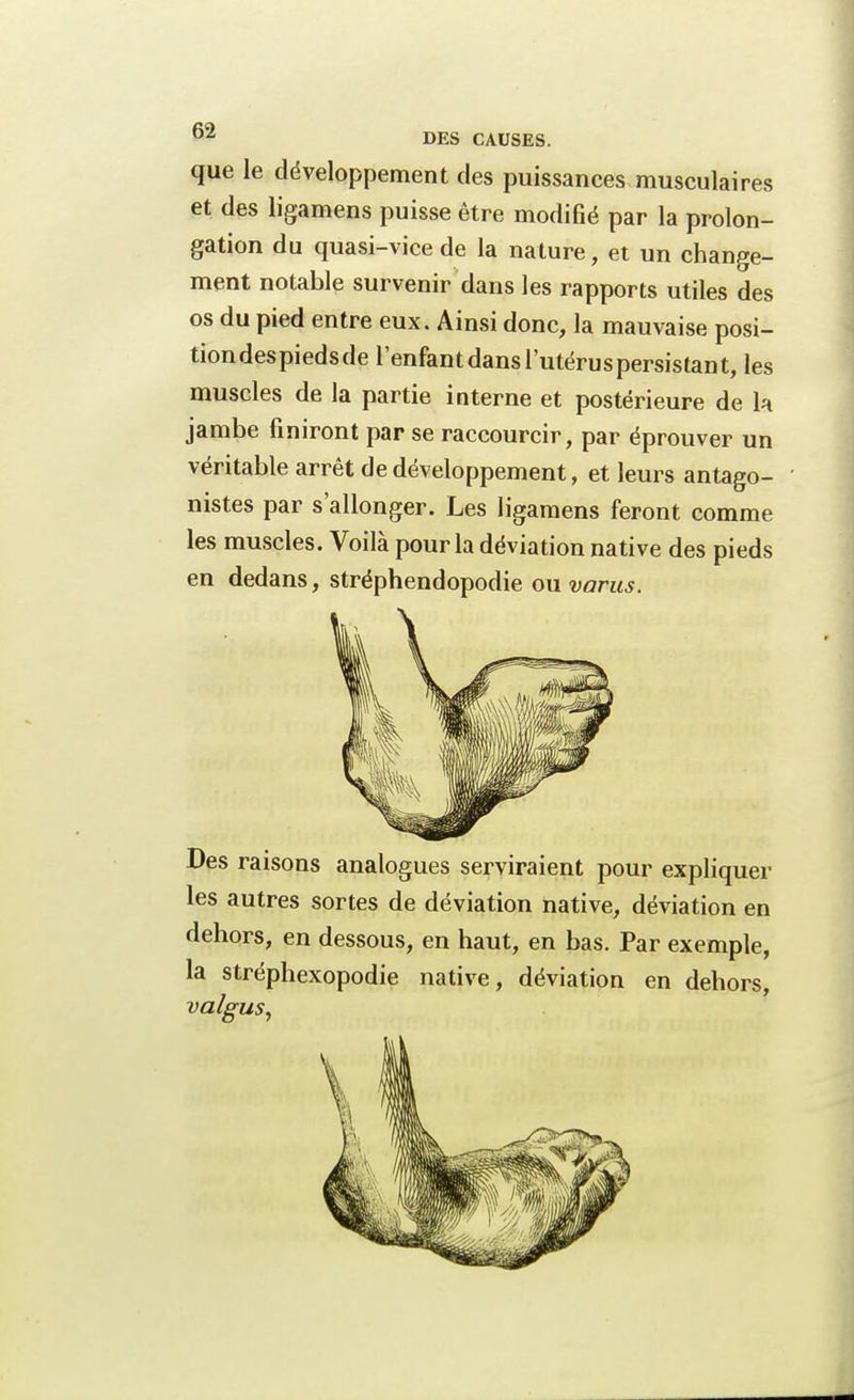 que le développement des puissances musculaires et des ligamens puisse être modifié par la prolon- gation du quasi-vice de la nature, et un change- ment notable survenir dans les rapports utiles des os du pied entre eux. Ainsi donc, la mauvaise posi- tion despieds de l'enfantdansl'utéruspersistant, les muscles de la partie interne et postérieure de la jambe finiront par se raccourcir, par éprouver un véritable arrêt de développement, et leurs antago- nistes par s'allonger. Les ligamens feront comme les muscles. Voilà pour la déviation native des pieds en dedans, stréphendopodie ou varus. Des raisons analogues serviraient pour expliquer les autres sortes de déviation native, déviation en dehors, en dessous, en haut, en bas. Par exemple, la stréphexopodie native, déviation en dehors, valgus,