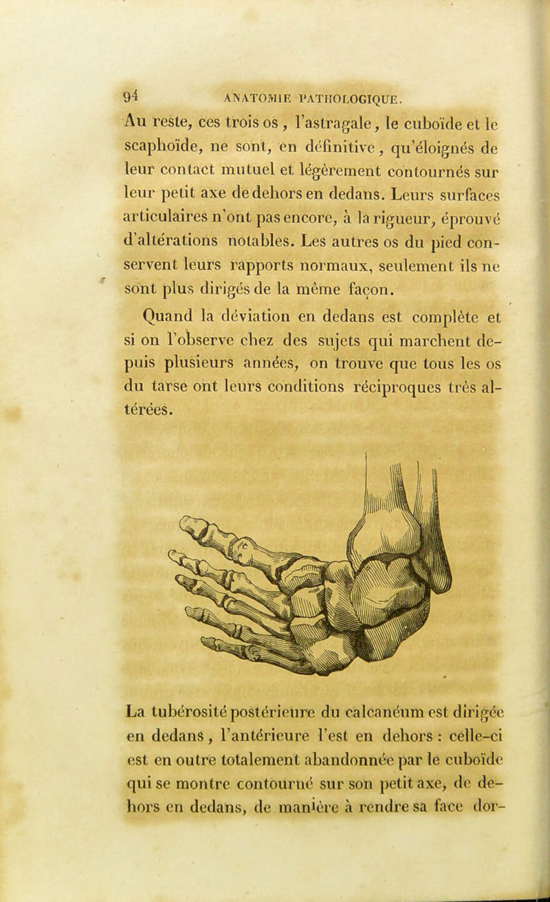 Au reste, ces trois os , l'astragale, le cuboïde et le scaphoïde, ne sont, en définitive, qu'éloignés de leur contact mutuel et légèrement contournés sur leur petit axe de dehors en dedans. Leurs surfaces articulaires n'ont pas encore, à la rigueur, éprouvé d'altérations notables. Les autres os du pied con- servent leurs rapports normaux, seulement ils ne sont plus dirigés de la même façon. Quand la déviation en dedans est complète et si on l'observe chez des sujets qui marchent de- puis plusieurs années, on trouve que tous les os du tarse ont leurs conditions réciproques très al- térées. La tubérosité postérieure du calcanéum est dirigée en dedans, l'antérieure l'est en dehors : celle-ci est en outre totalement abandonnée par le cuboïde qui se montre contourné sur son petit axe, de de- hors en dedans, de manière à rendre sa face dor-